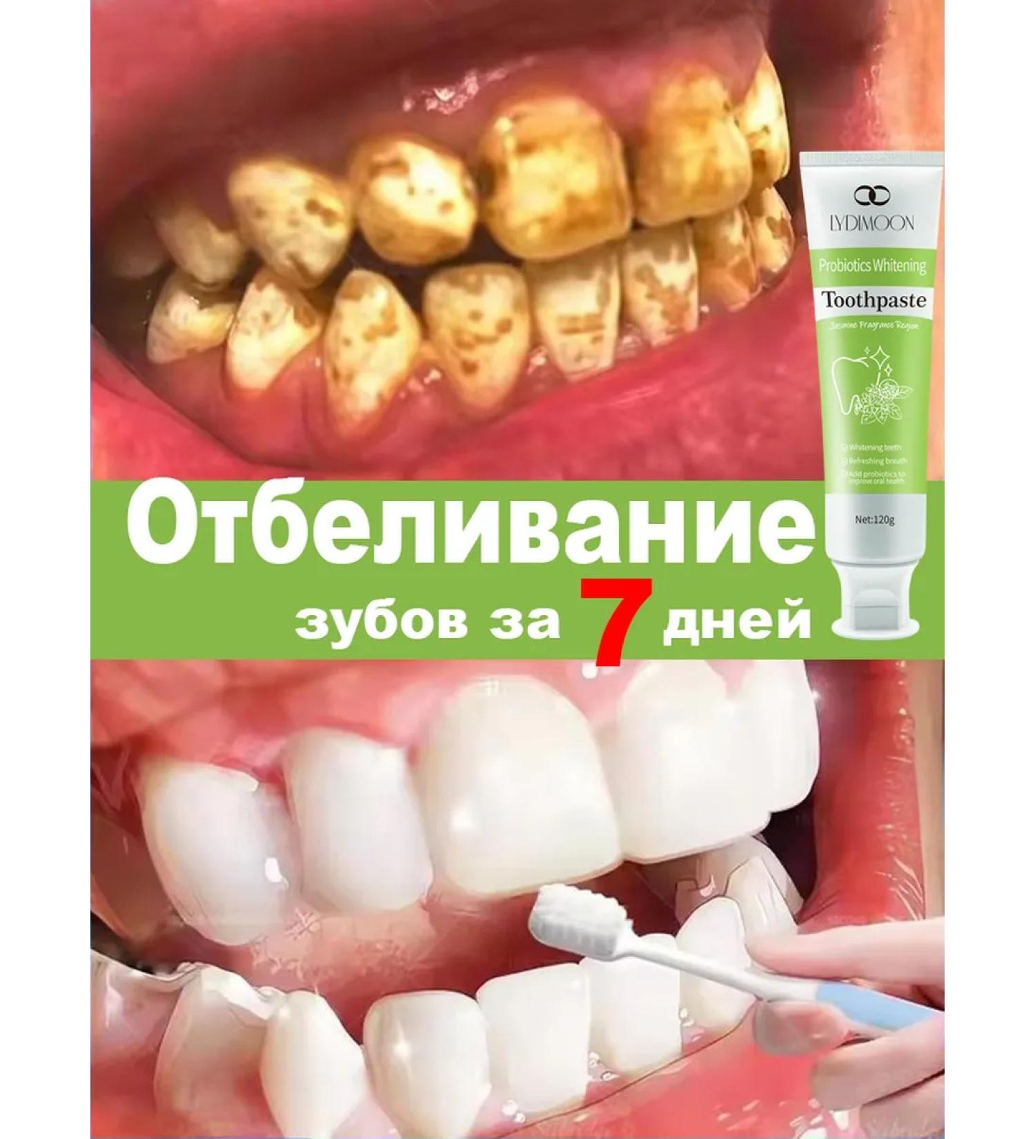 LYDIMOON Toothpaste to remove tooth stone and bleaching teeth - Buy Online on GoSupps.com