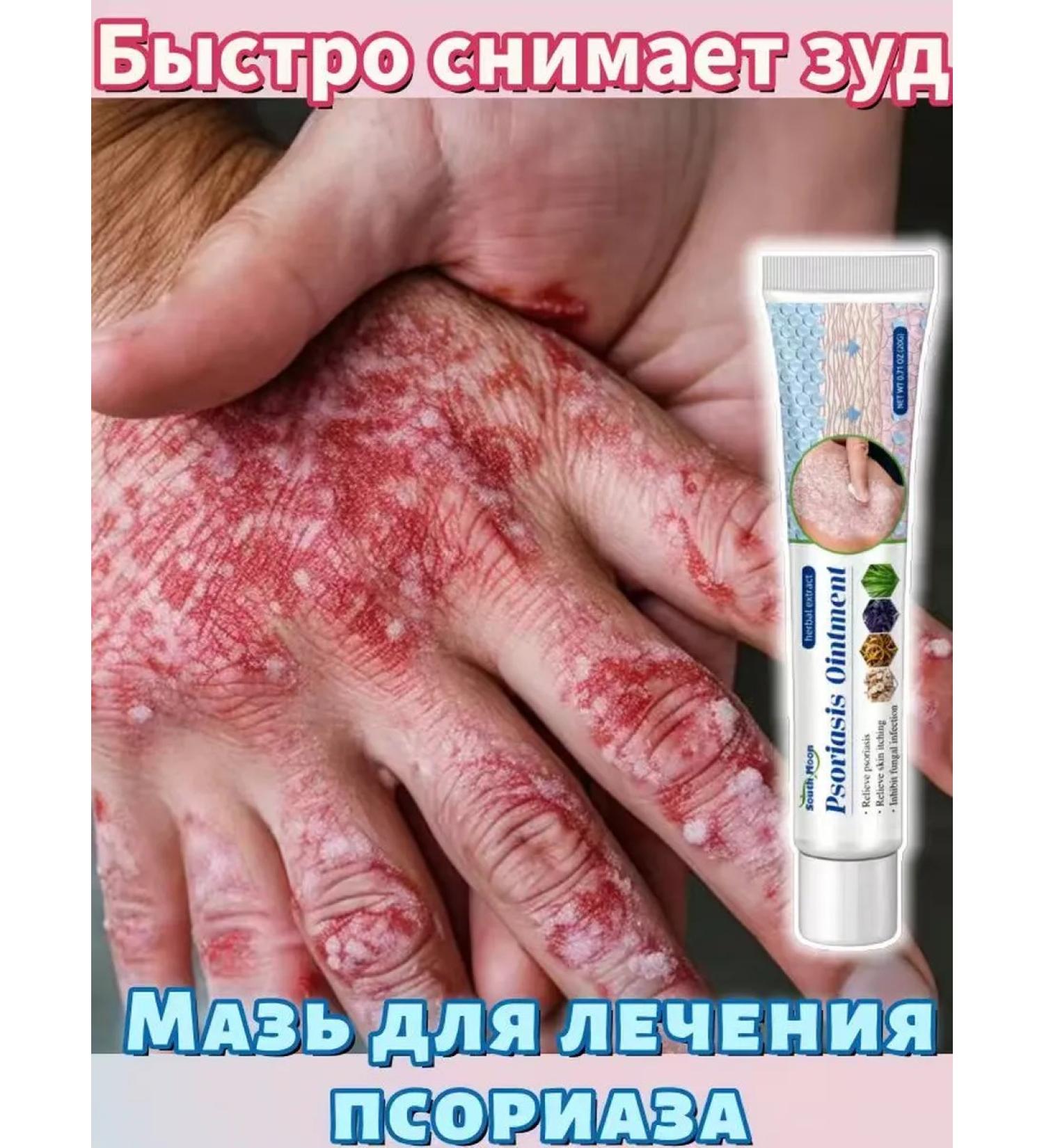 DRSKINVITA Chinese miracle cream from psoriasis and dermatitis - Buy Online on GoSupps.com
