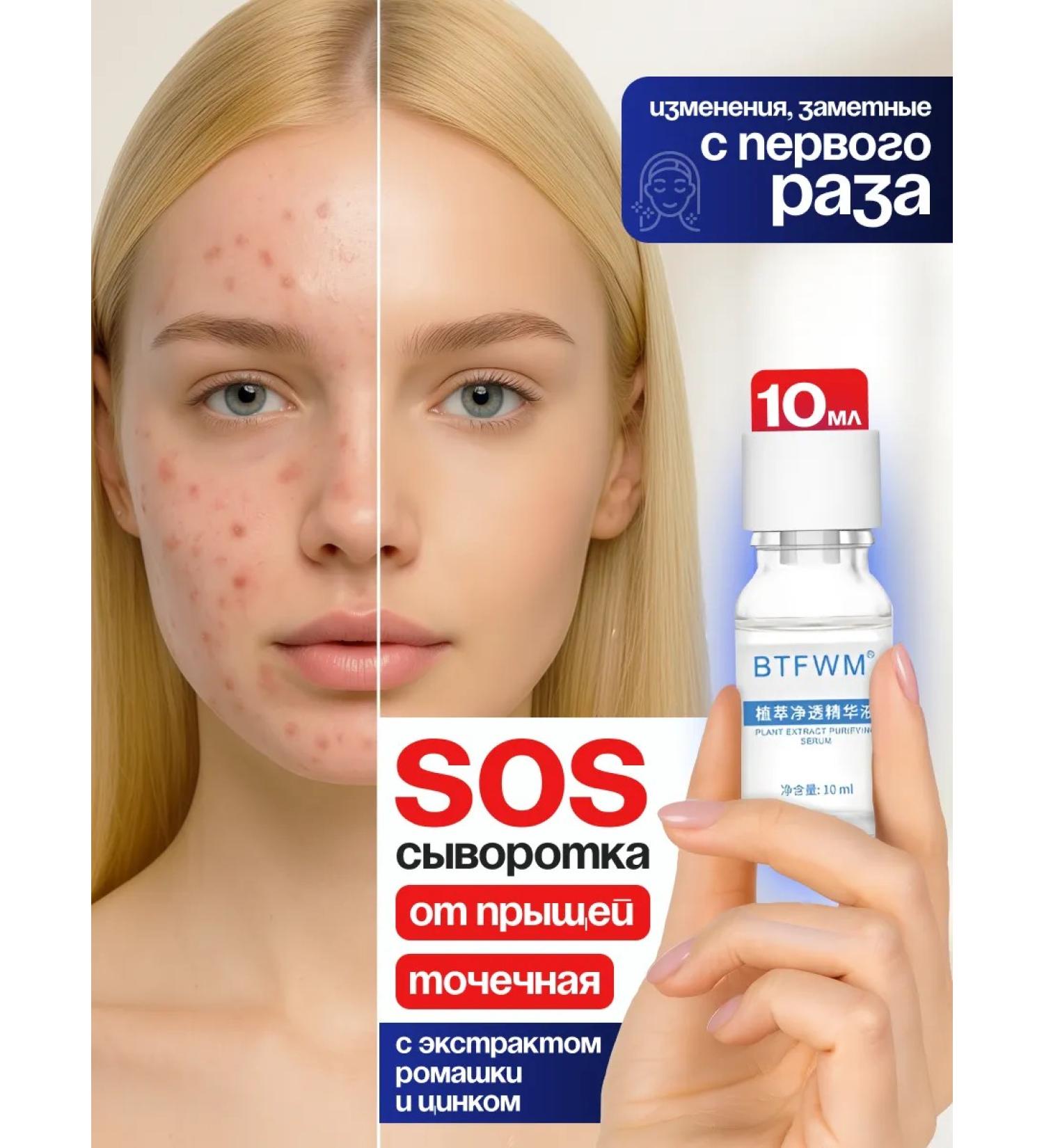 Plant acne remedy 10 ml - Buy Online on GoSupps.com