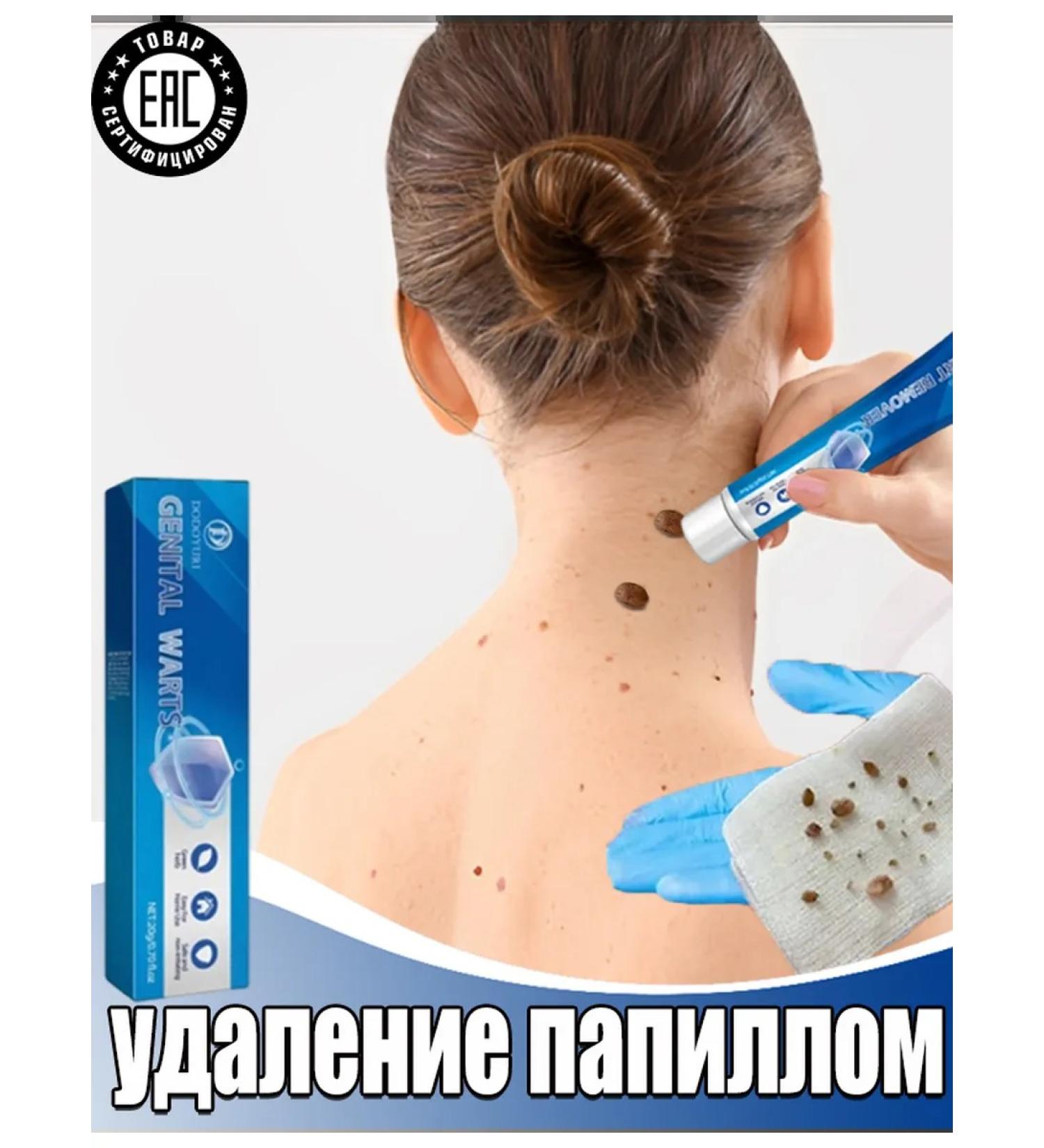 Cream for quick removal of papillomas and warts - Buy Online on GoSupps.com