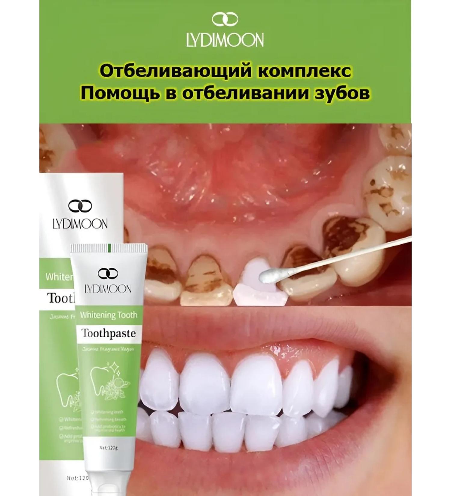 LYDIMOON Toothpaste for teeth whitening 120 g - Buy Online on GoSupps.com