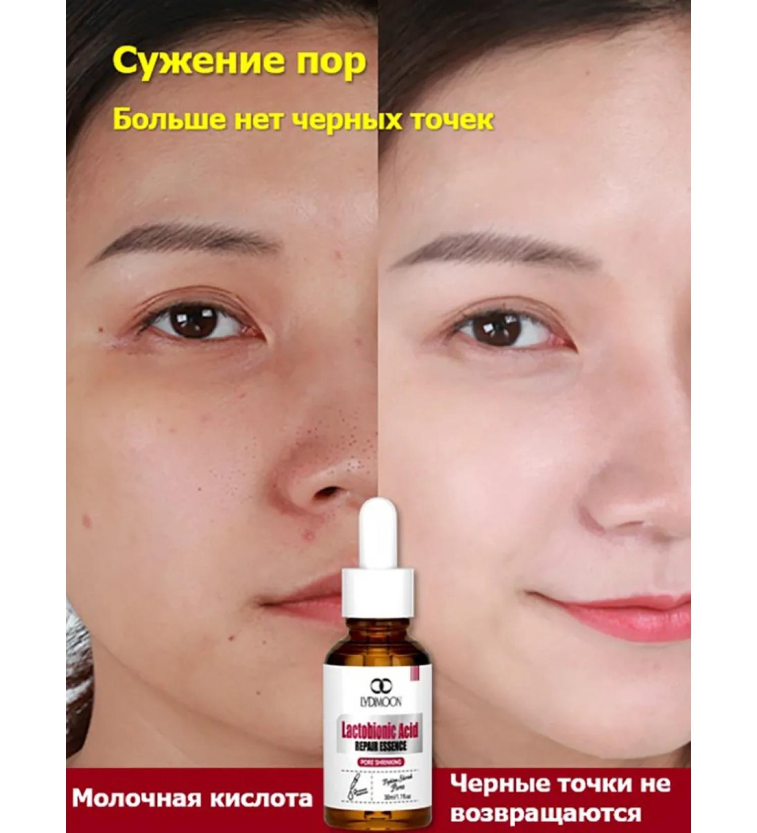 LYDIMOON Essence for recovery with lactoic acid 30 mi - Buy Online on GoSupps.com