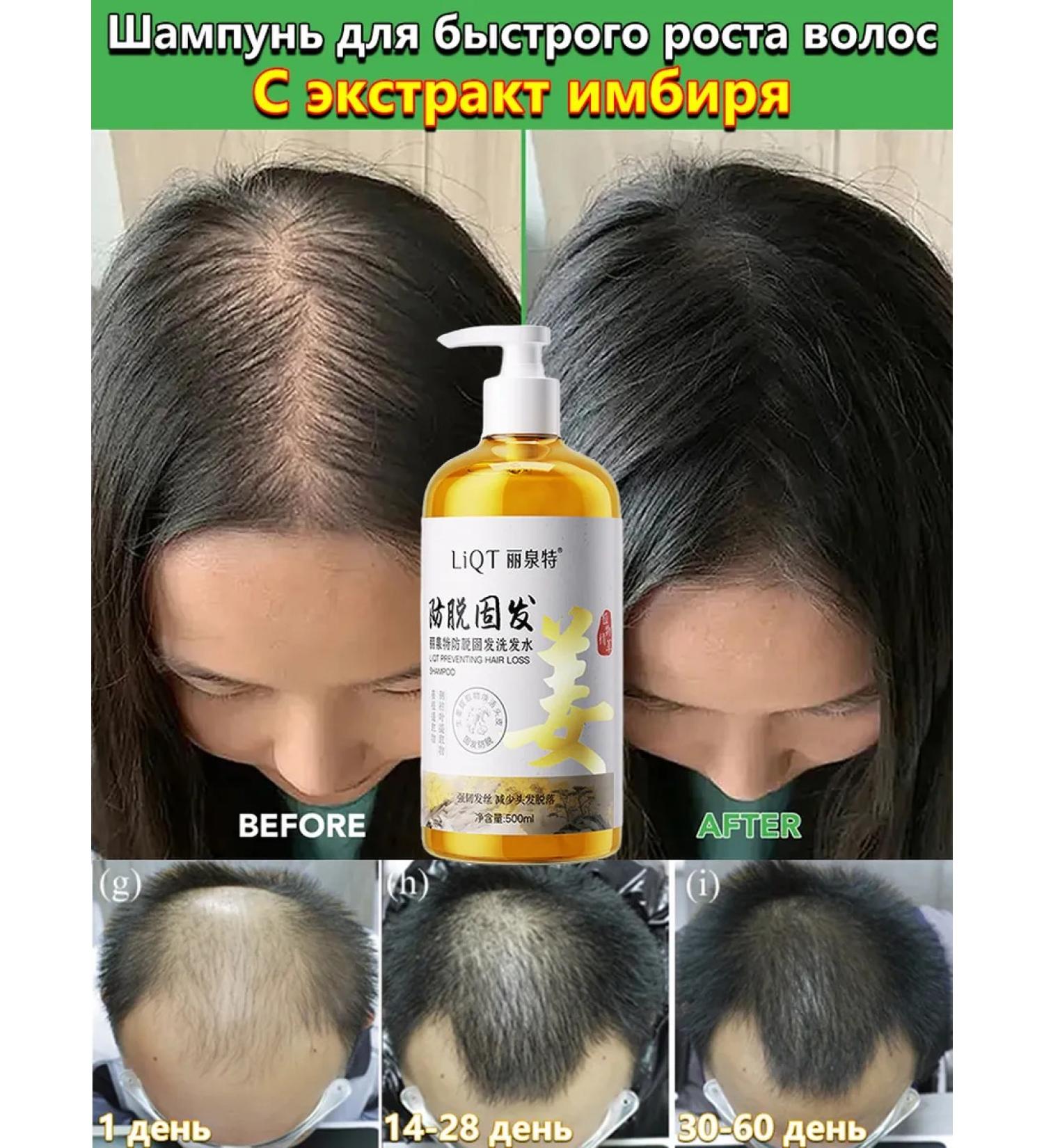 Shampoo for hair growth and loss with ginger and ginseng - Buy Online on GoSupps.com