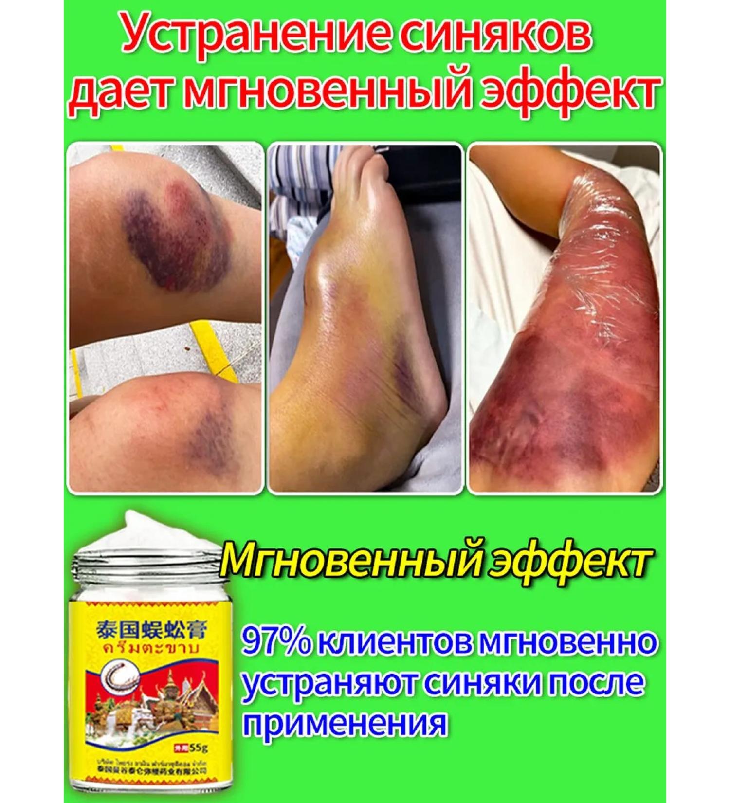 Badyaga from bruises ointment and hematoma 55r - Buy Online on GoSupps.com