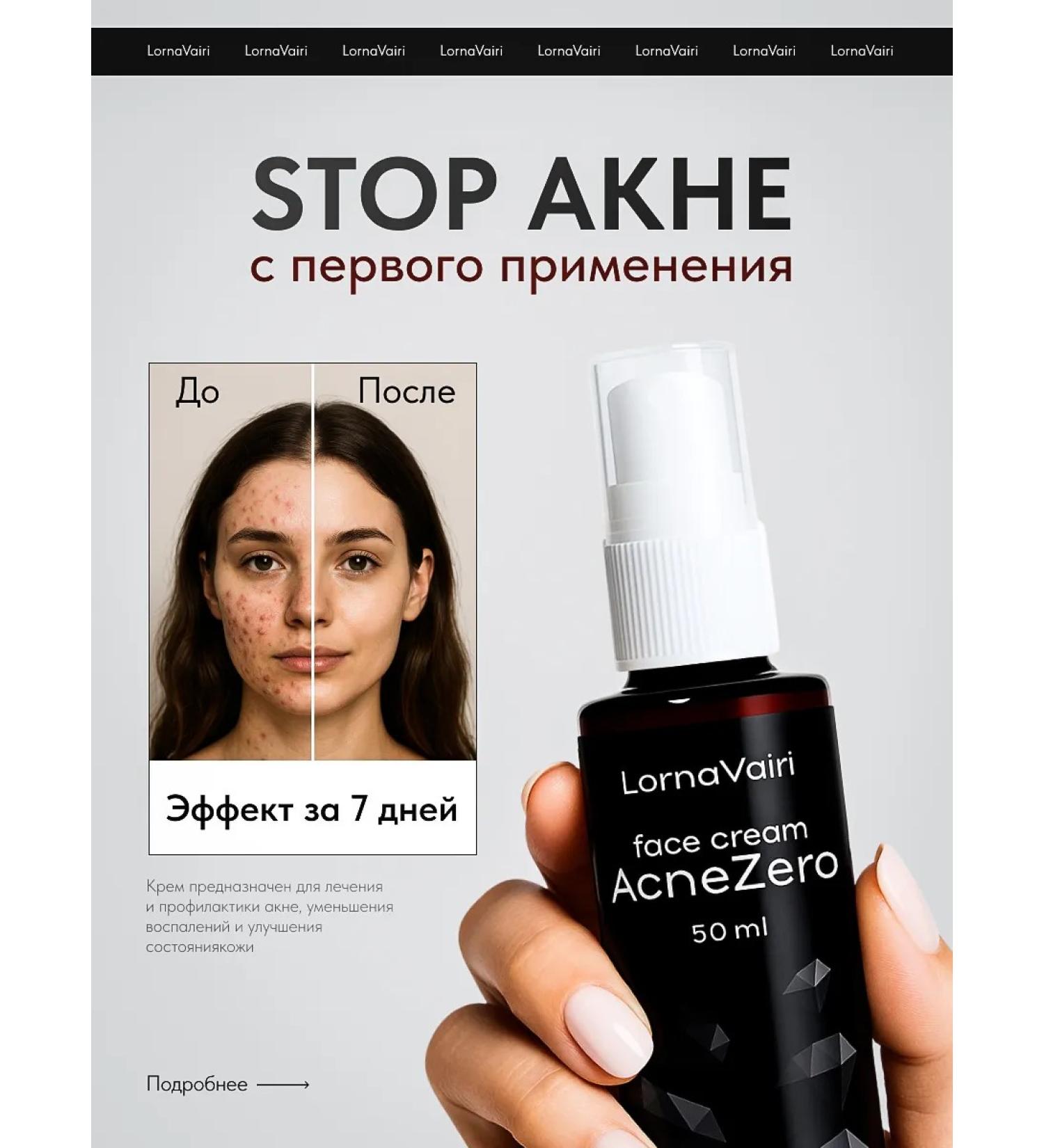 Lorna Vairi AcneZero Acne cream and face - Buy Online on GoSupps.com