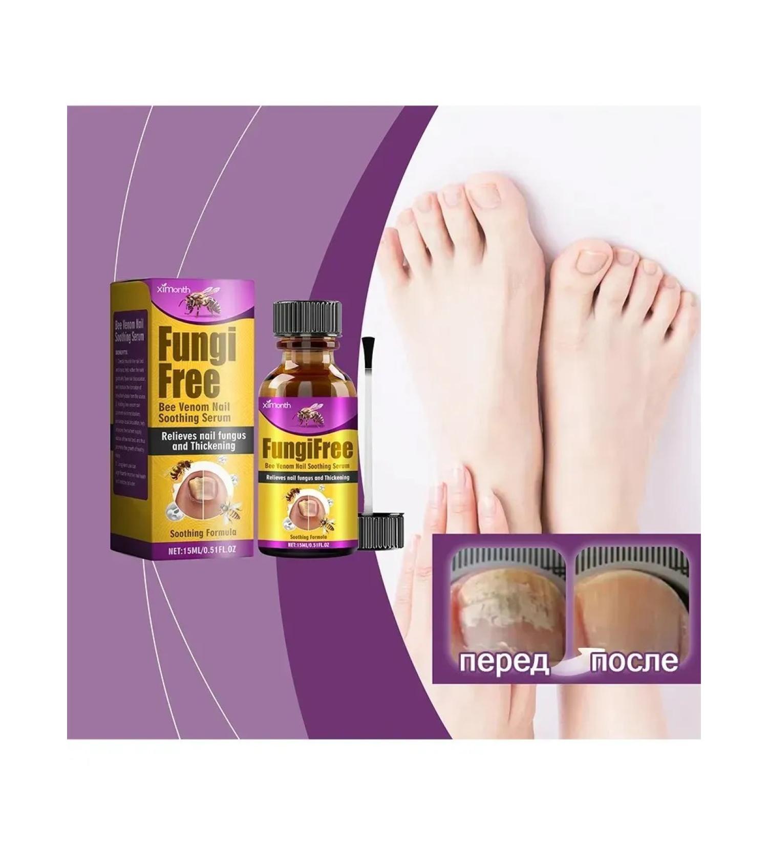 Nail fungus Care fluid bee poison contribute to growth - Buy Online on GoSupps.com
