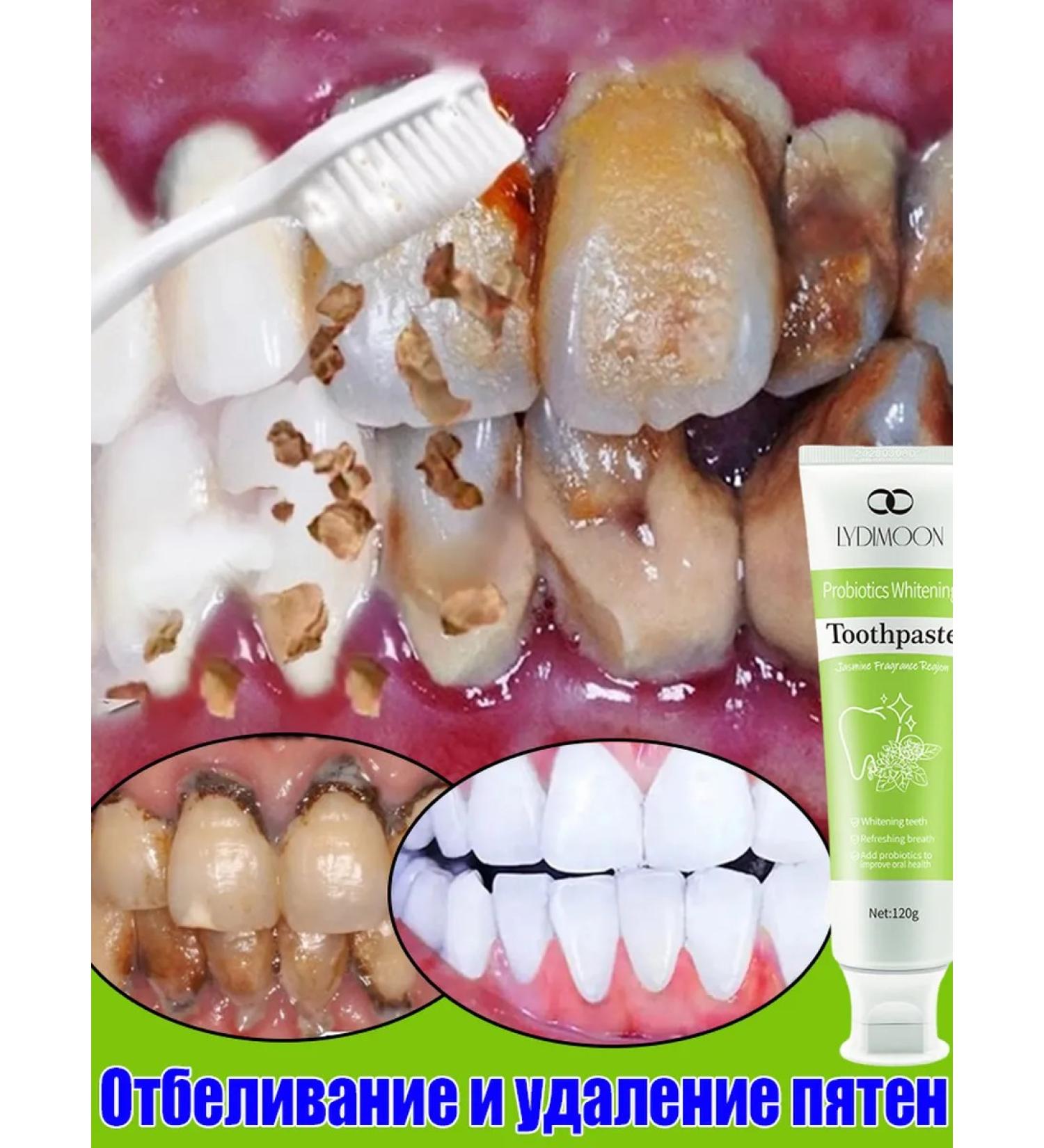 LYDIMOON Whitening toothpaste Professional 120 g - Buy Online on GoSupps.com