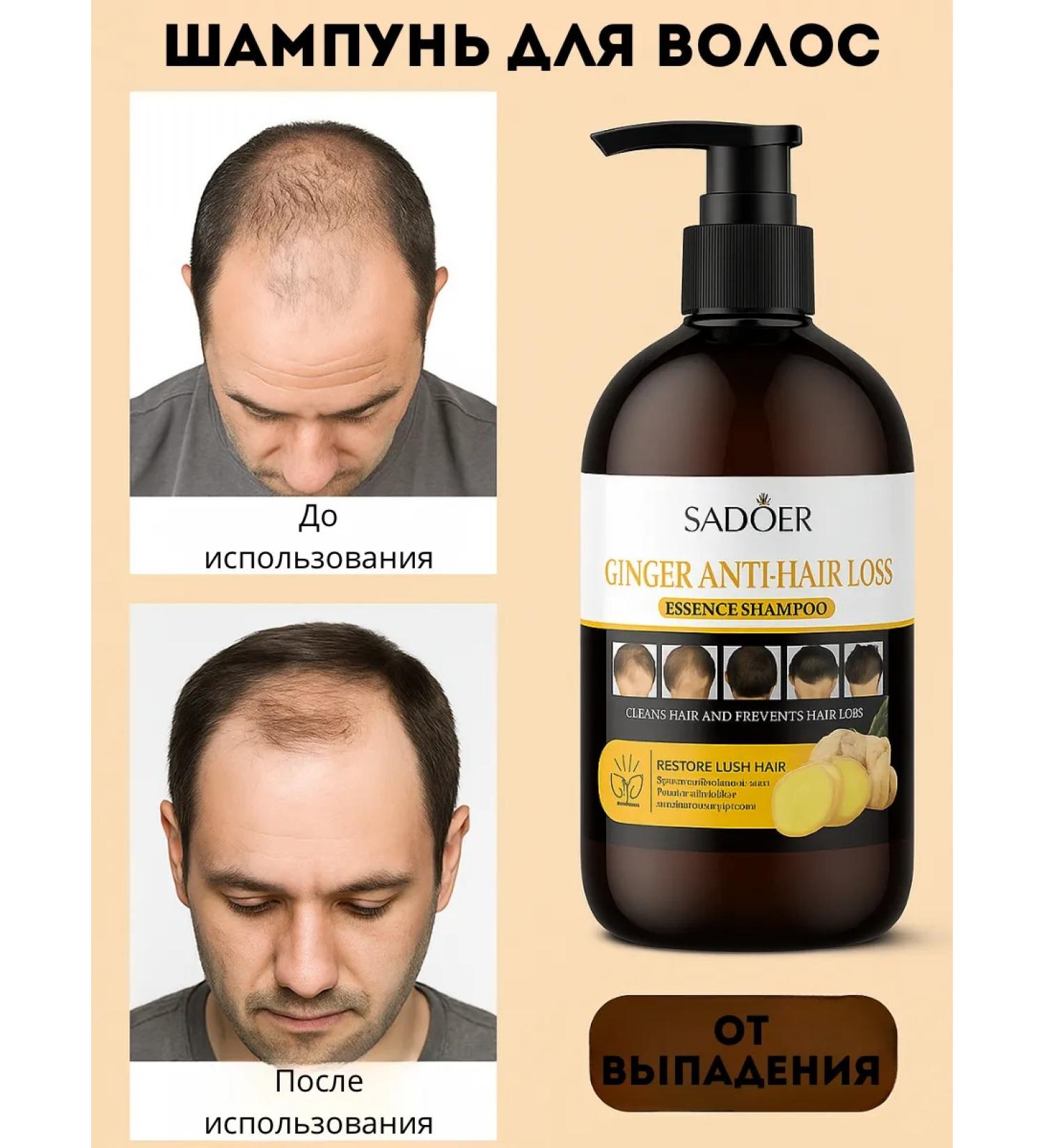 TA1612 Hair dropping shampoo with ginger extract - Buy Online on GoSupps.com
