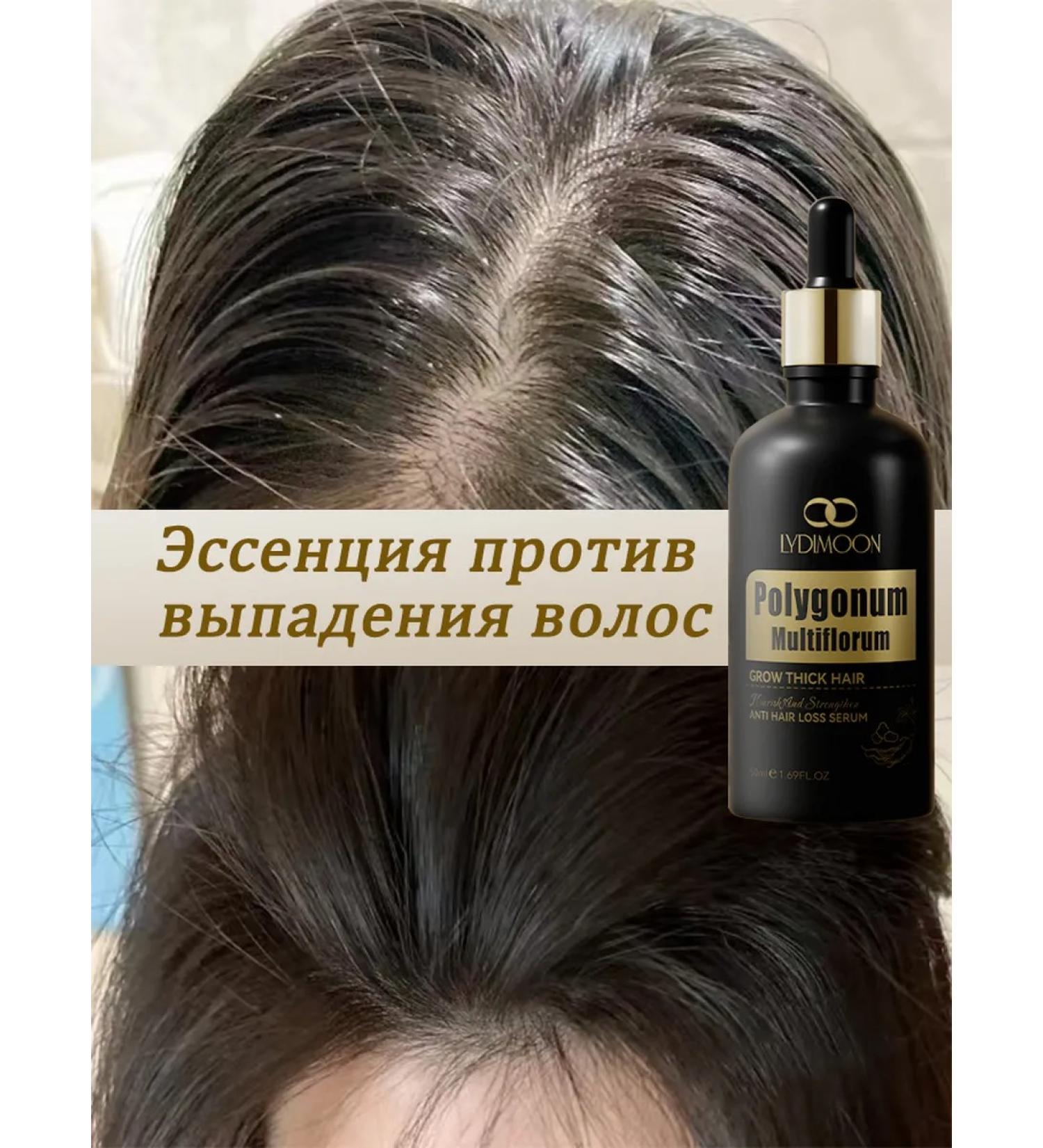 LYDIMOON 3 bottles of essence against hair loss of 50 ml - Buy Online on GoSupps.com