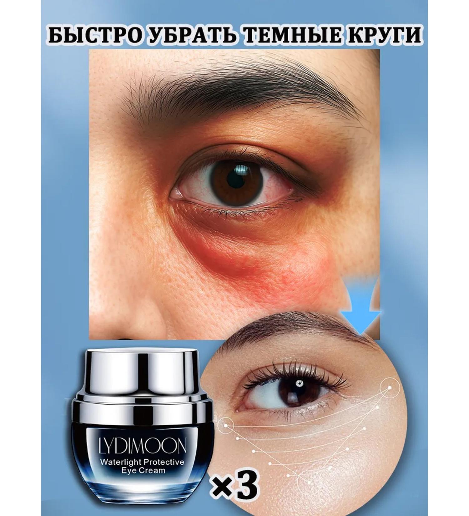 LYDIMOON Anti-aging eye cream for puffiness and bags under the eyes 40 g 3 bottles - Buy Online on GoSupps.com