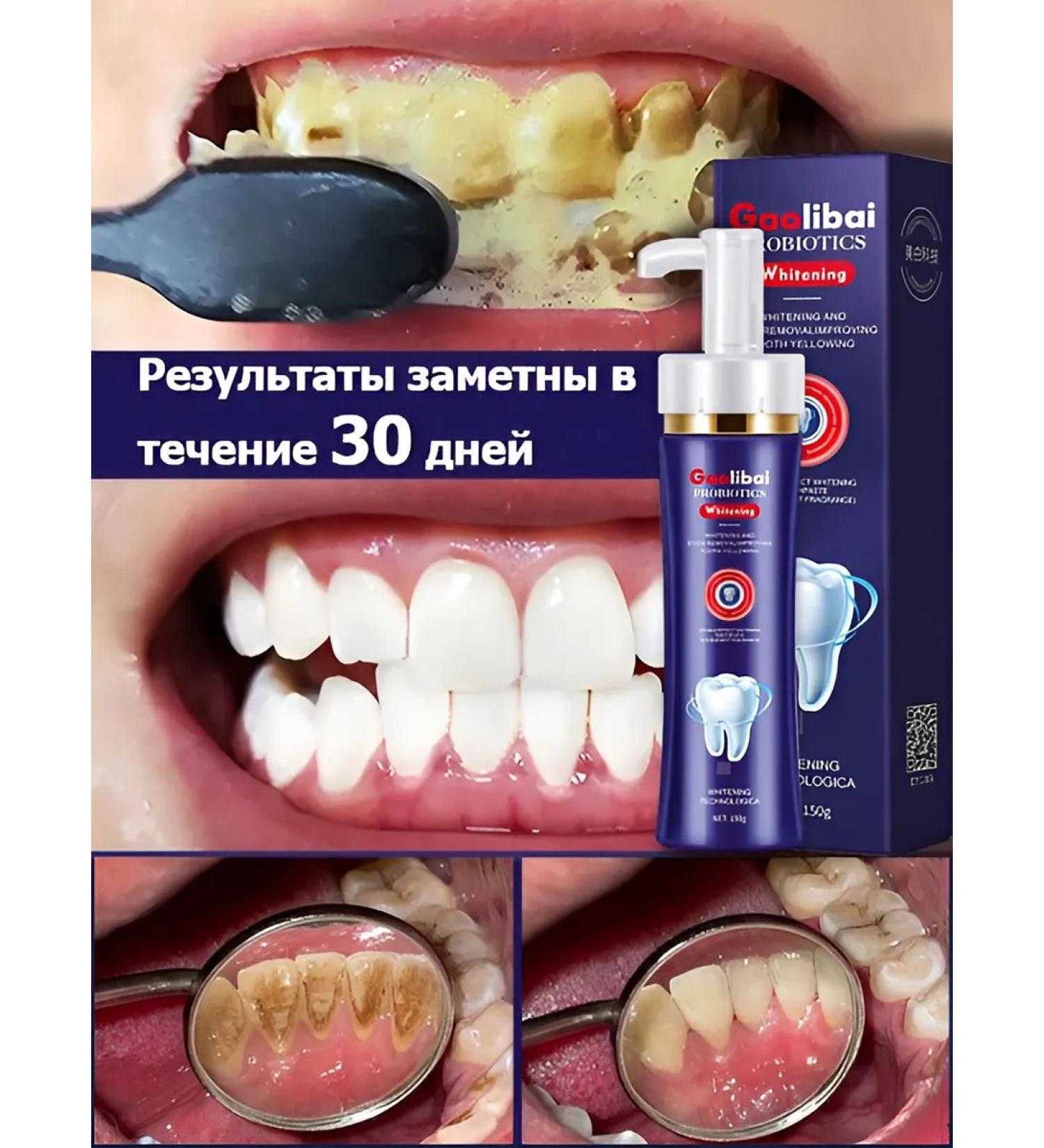 LYDIMOON Bleaching toothpaste 150 g - Buy Online on GoSupps.com