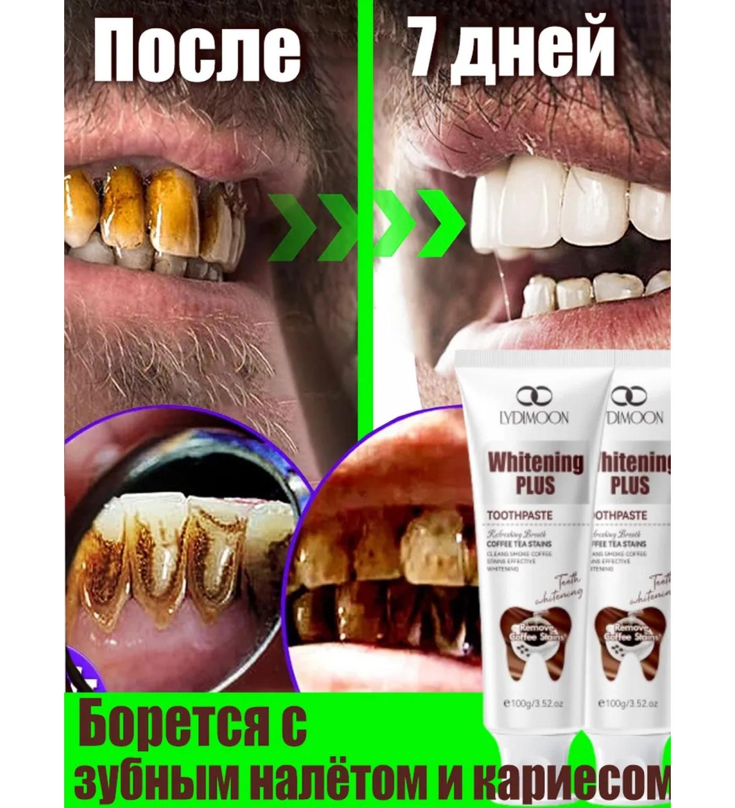 LYDIMOON Toothpaste prevention of gum disease for 100 g - Buy Online on GoSupps.com