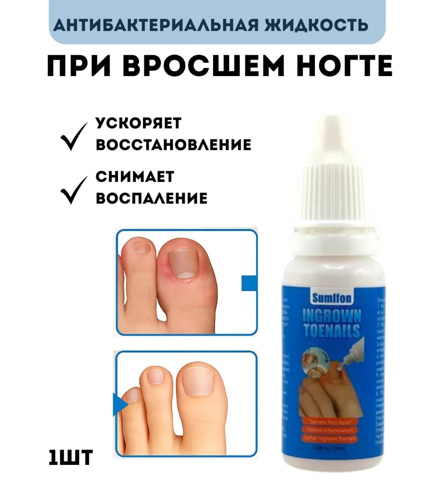 mua Remedy for the restoration of ingrown nails on the legs - Buy Online on GoSupps.com
