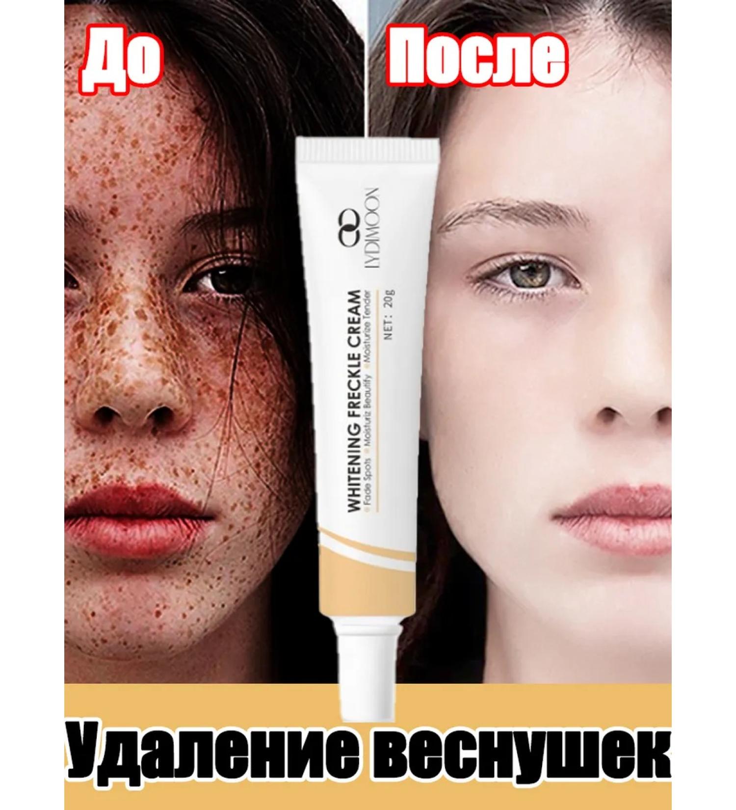 Cream against pigmentation clarification and removal of spots - Buy Online on GoSupps.com