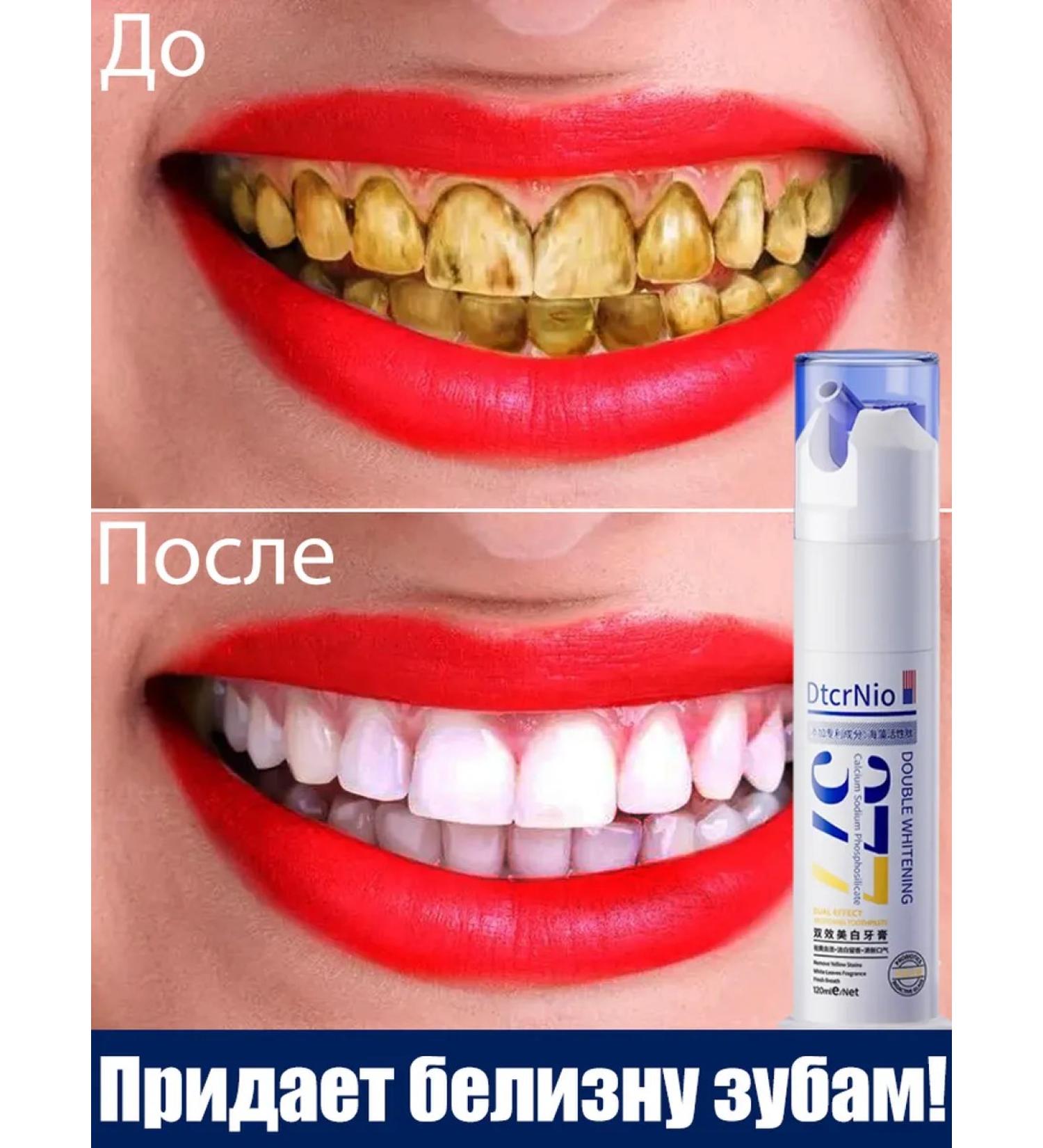 Whitening toothpaste eliminates pigmentation on the teeth - Buy Online on GoSupps.com