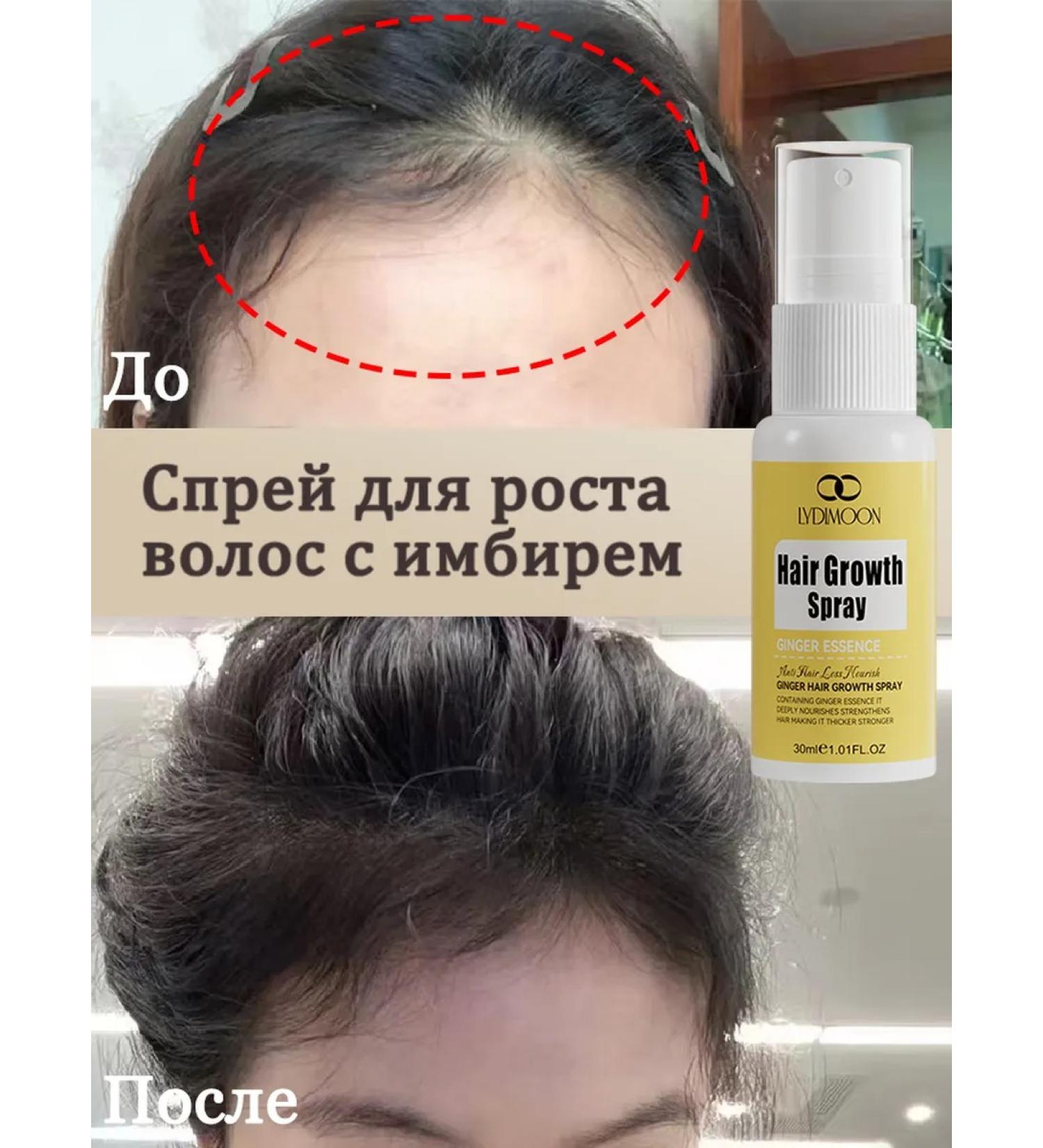 LYDIMOON Hair growth spray with ginger 30 ml 3 bottles - Buy Online on GoSupps.com