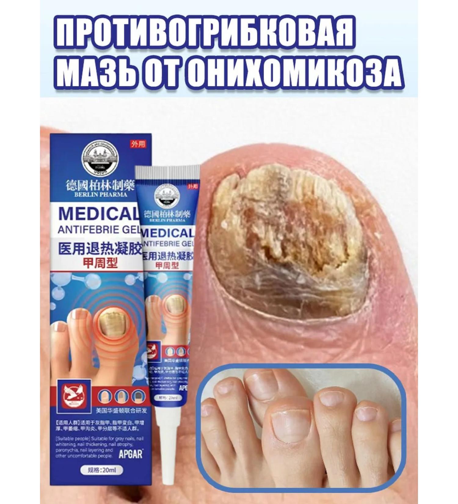 Antifungal ointment from nail fungus and feet - Buy Online on GoSupps.com