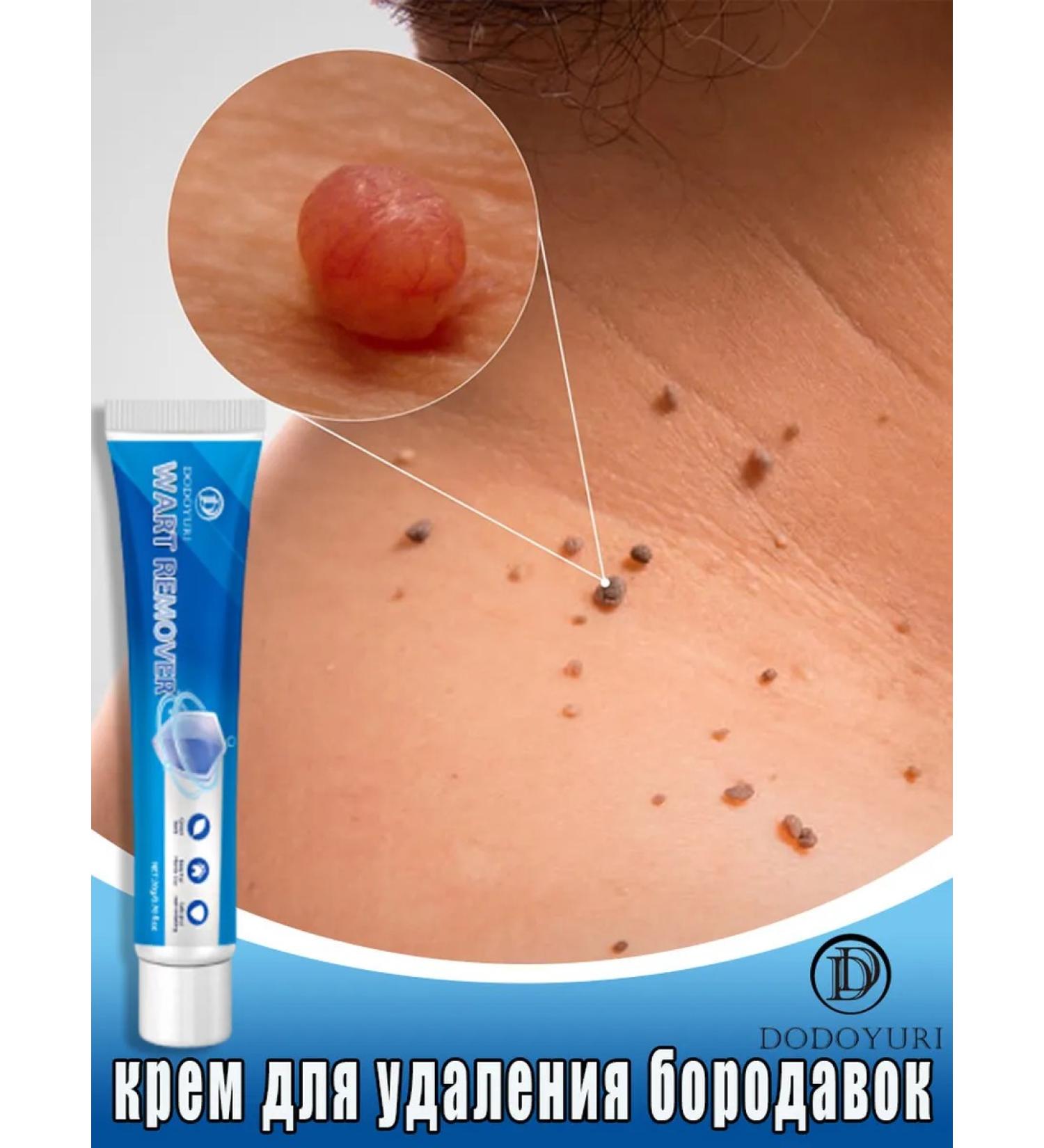 From papillomas and warts 20g - Buy Online on GoSupps.com