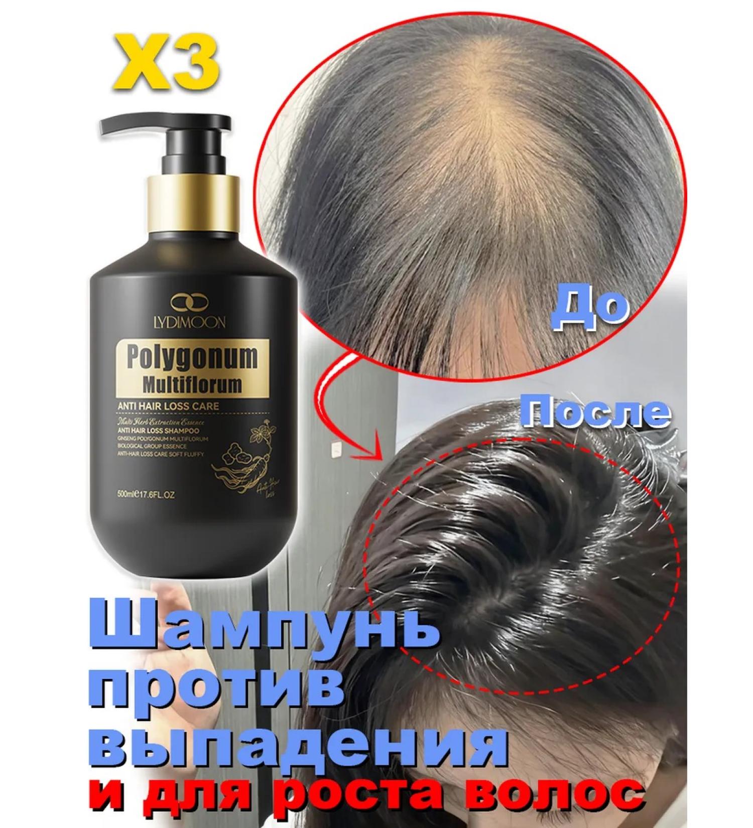 Shampoo against falling out and for the growth of the wave （3 bottles）