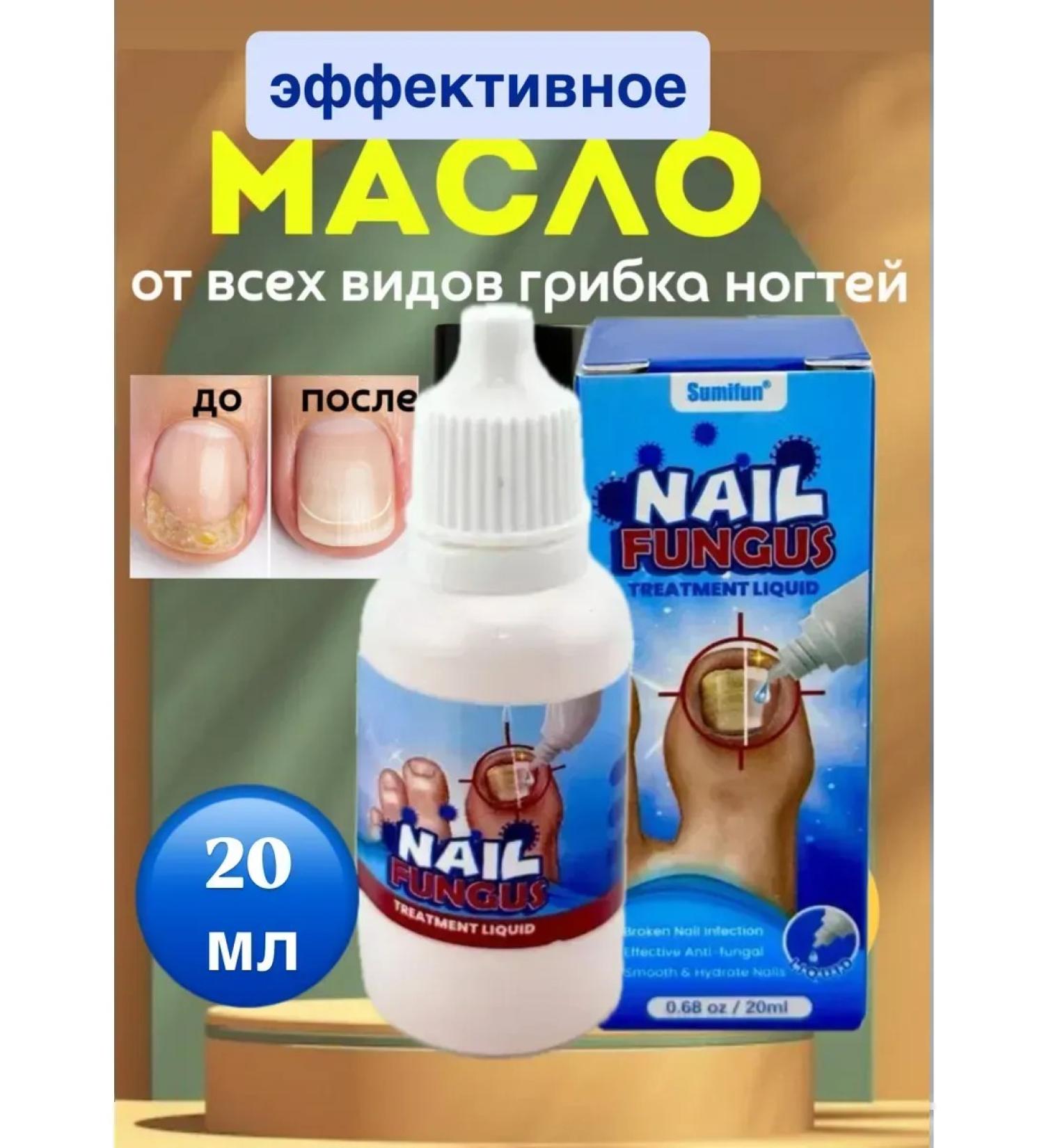 Remedy for toenail fungus - Buy Online on GoSupps.com