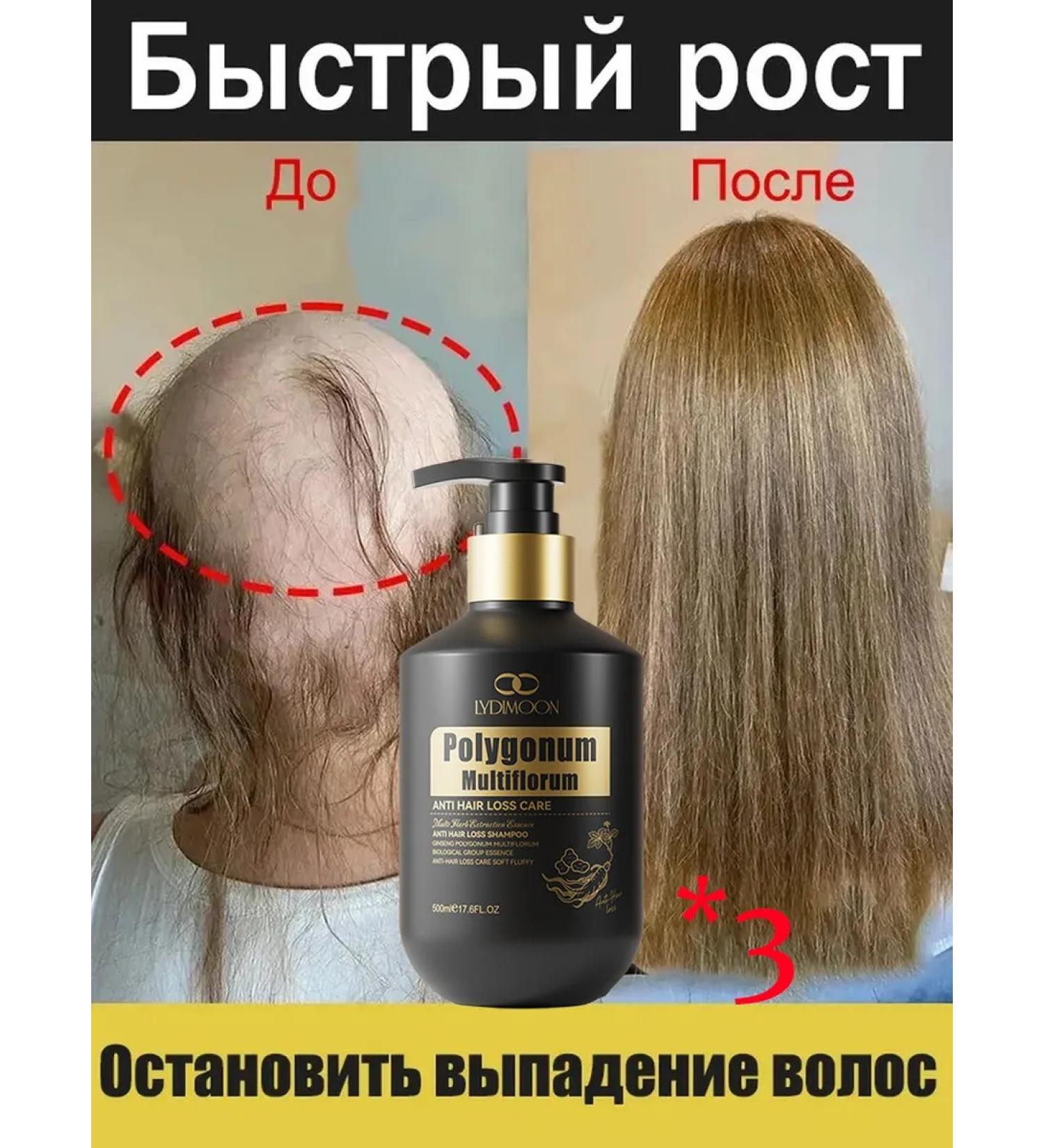 LYDIMOON Hair growth shampoo 500 g based on oriental recipes - Buy Online on GoSupps.com