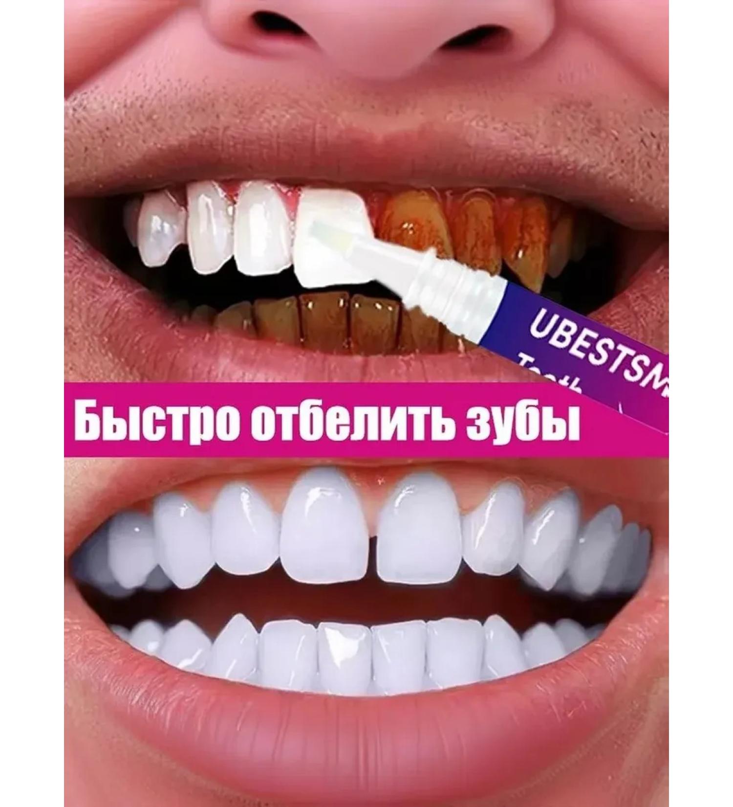 LYDIMOON Bleaching dental handles 2 pcs. package - Buy Online on GoSupps.com