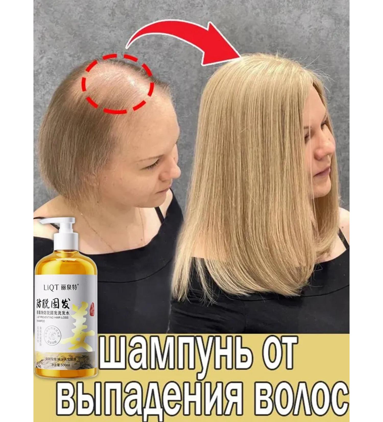 Ginger shampoo against hair loss and hair growth - Buy Online on GoSupps.com