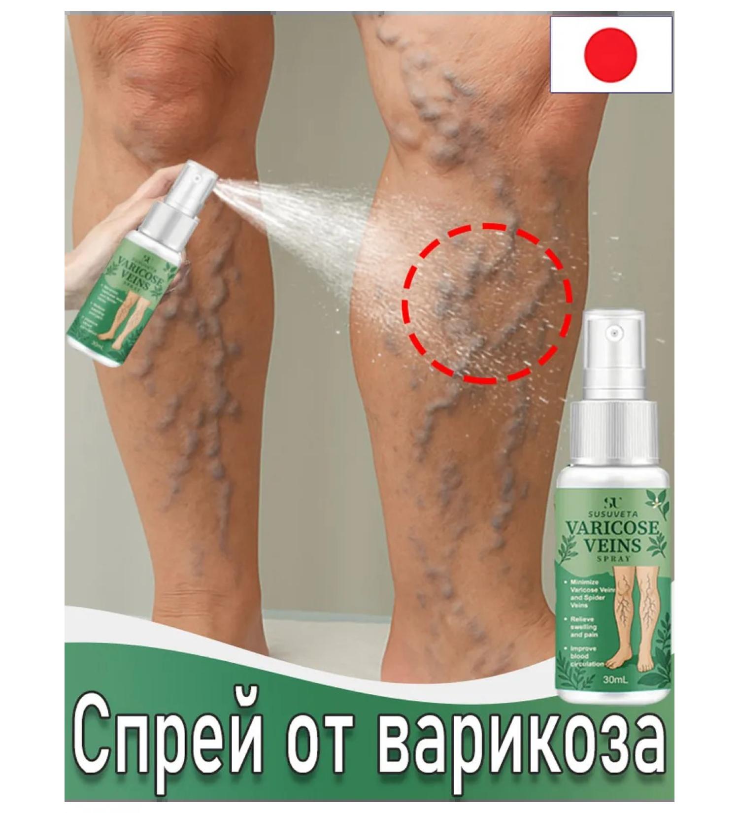 The spray from varicose veins effectively treats edema 30 ml - Buy Online on GoSupps.com