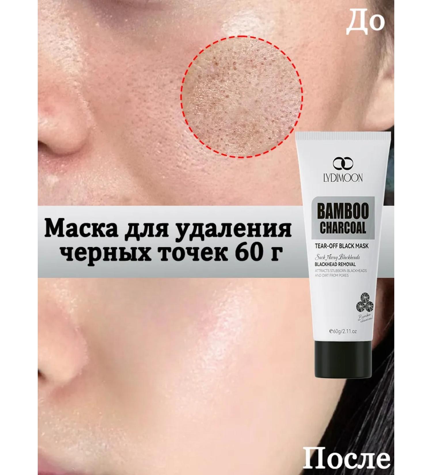 LYDIMOON Mask for removing black dots 60 g 5 pcs - Buy Online on GoSupps.com