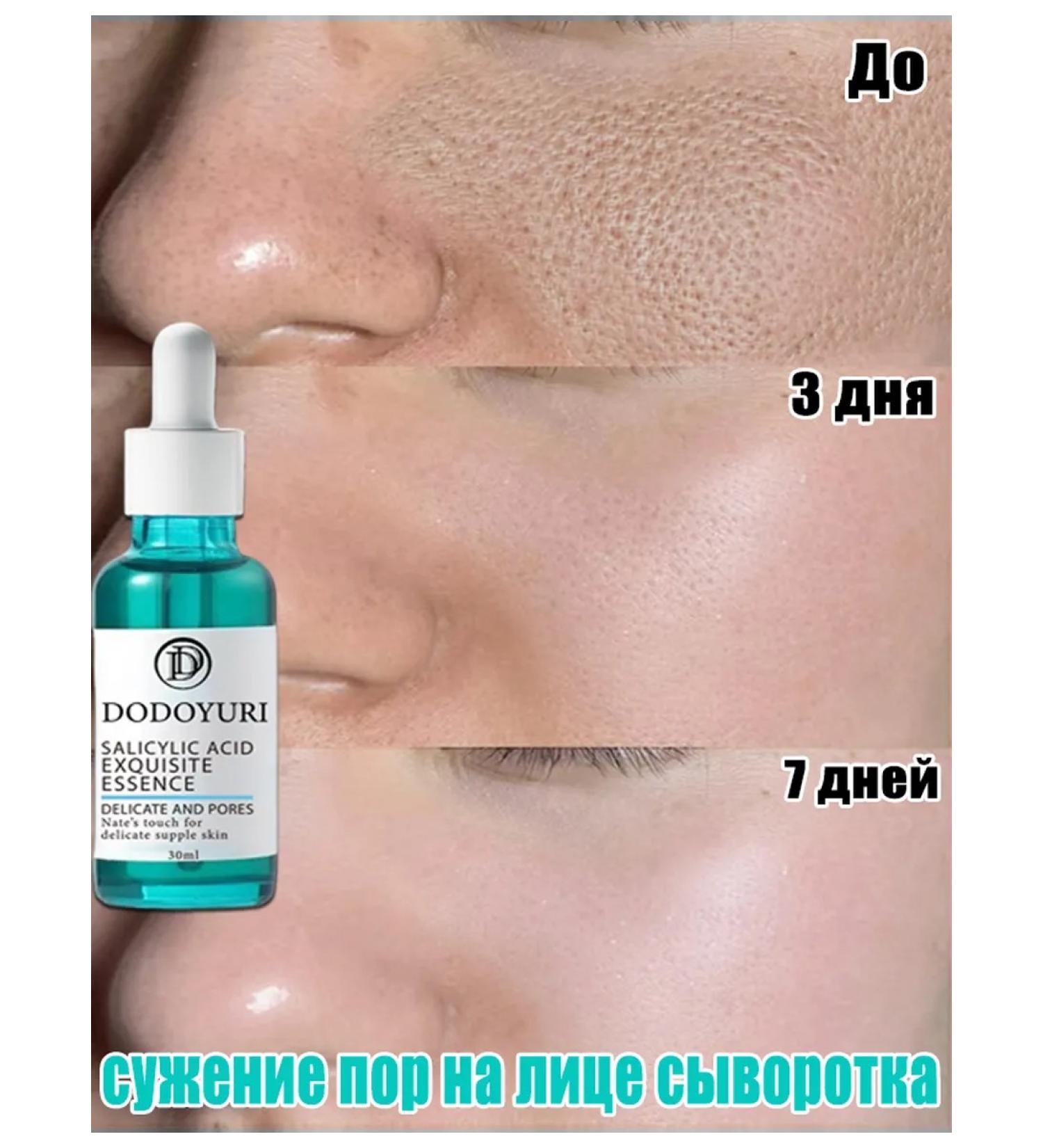 Salicylic acid for the face serum for narrowing pores 30 ml - Buy Online on GoSupps.com