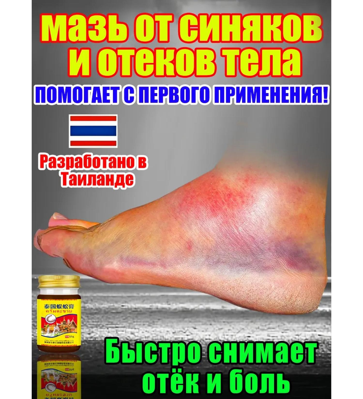 Ointment from bruises and edema of the body 120ml - Buy Online on GoSupps.com