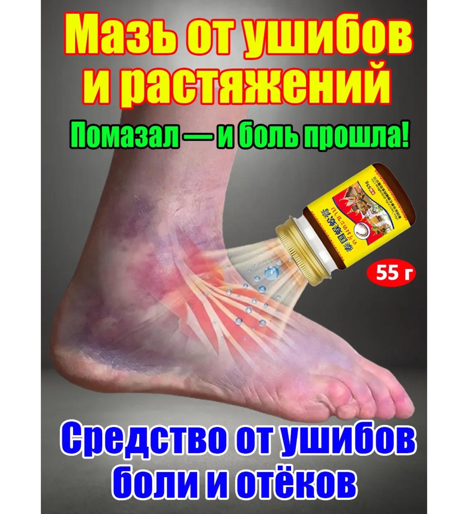 Ointment from bruises and hematomas 55 g - Buy Online on GoSupps.com