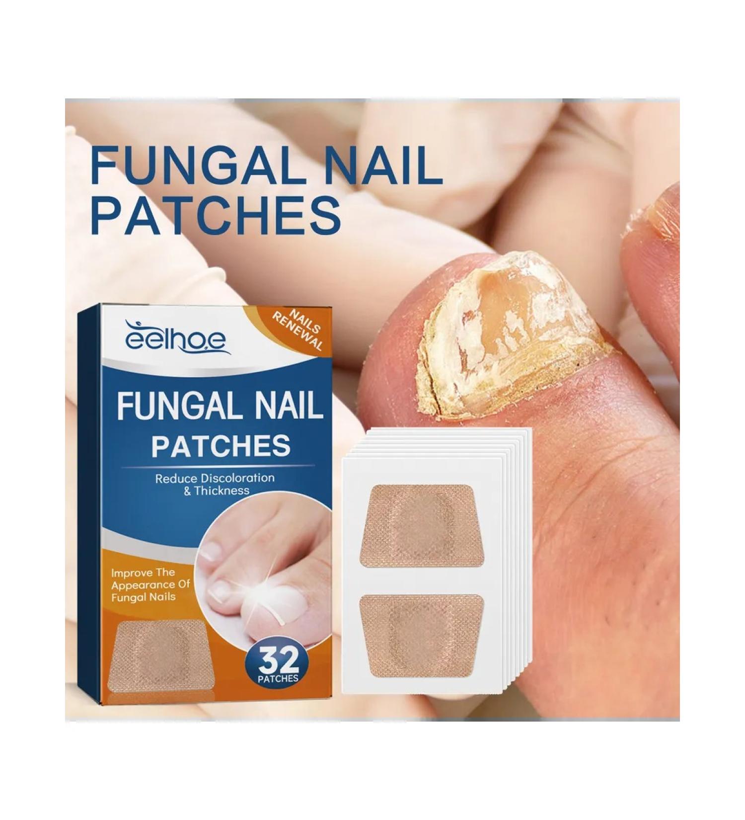 Eelhoe fungus of gray nail thickenation restoration manual - Buy Online on GoSupps.com