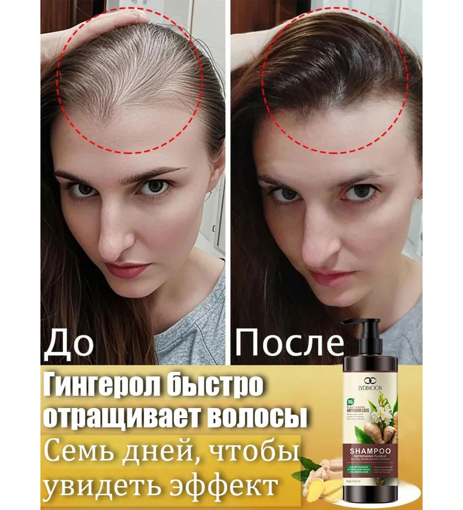 LYDIMOON Shampoo against falling out and for powerful hair growth female - Buy Online on GoSupps.com