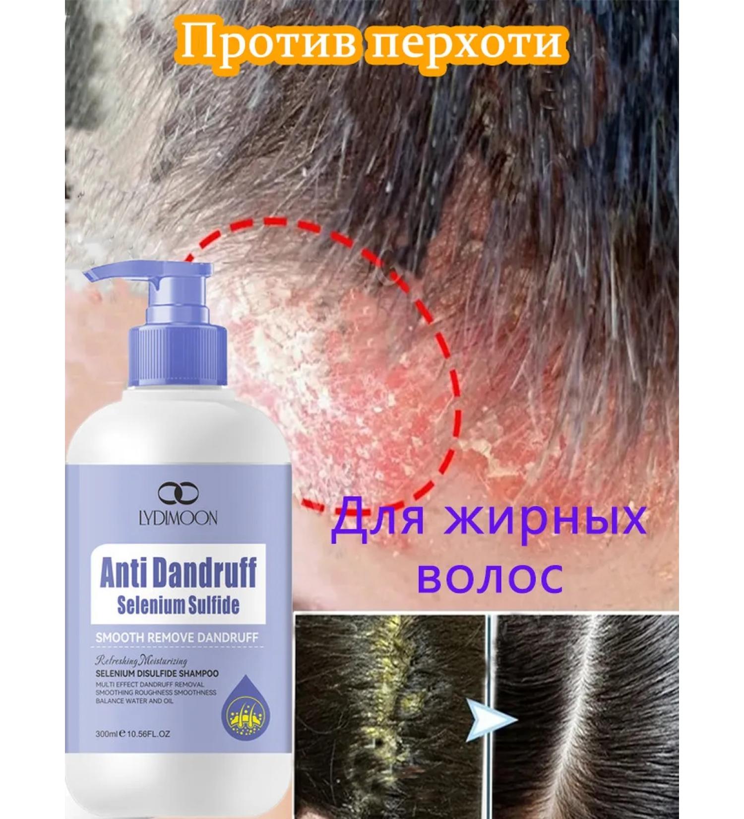 LYDIMOON Shampoo against dandruff with selenium disulfide 300 ml - Buy Online on GoSupps.com
