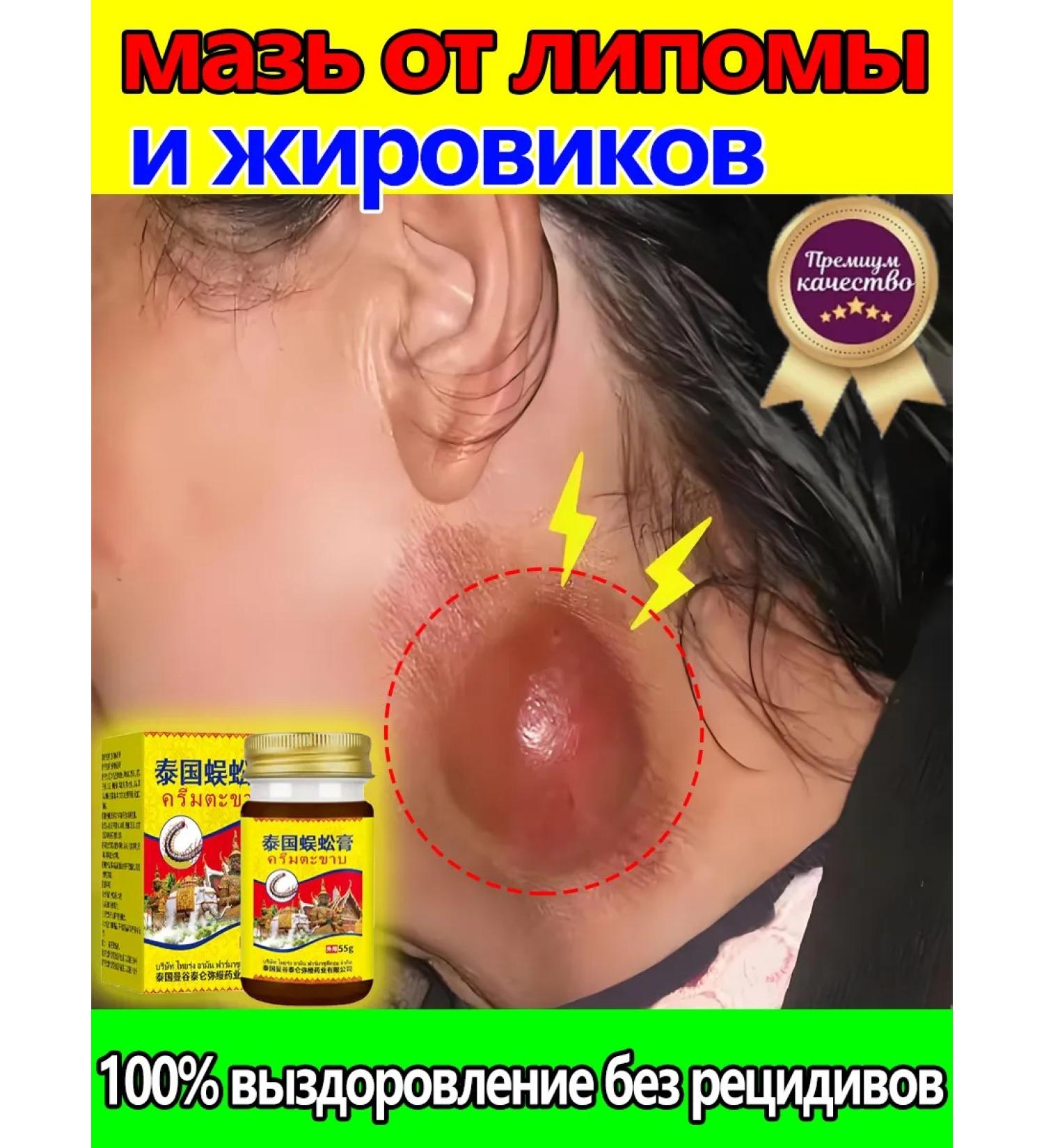 Ointment from Lipoma and Girovikov 55 g - Buy Online on GoSupps.com