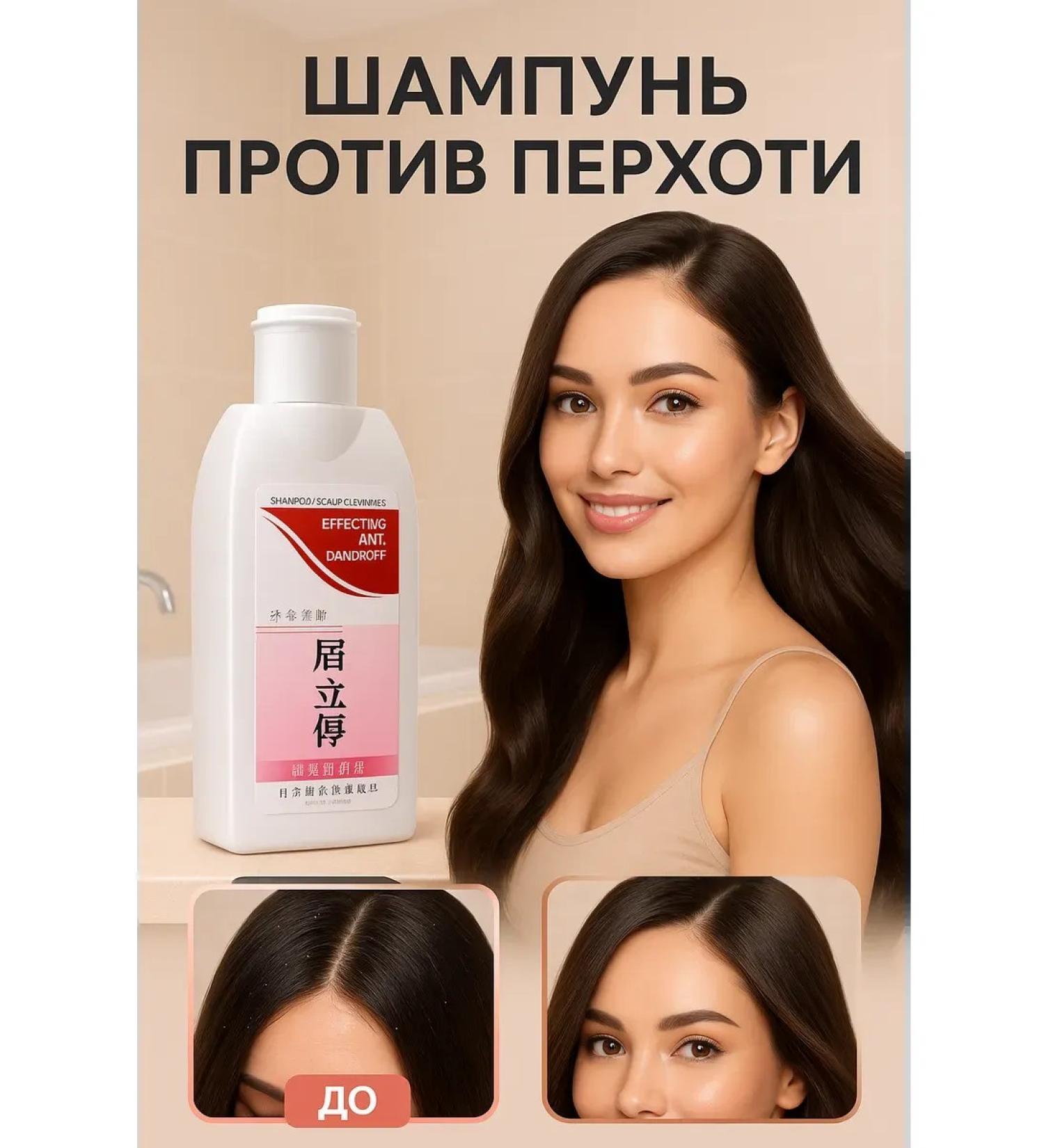 GKM1 effective shampoo against dandruff - Buy Online on GoSupps.com
