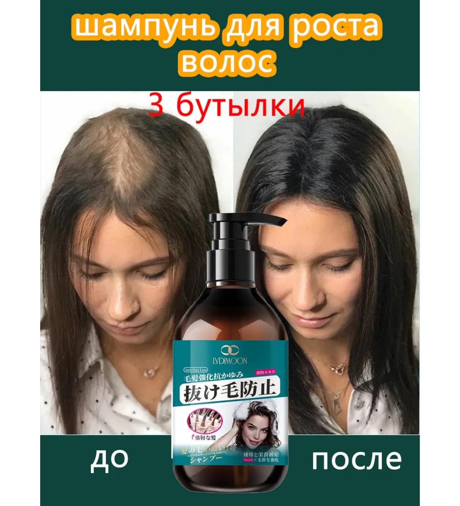 LYDIMOON Shampoo from hair loss for growth 300ml*3 - Buy Online on GoSupps.com