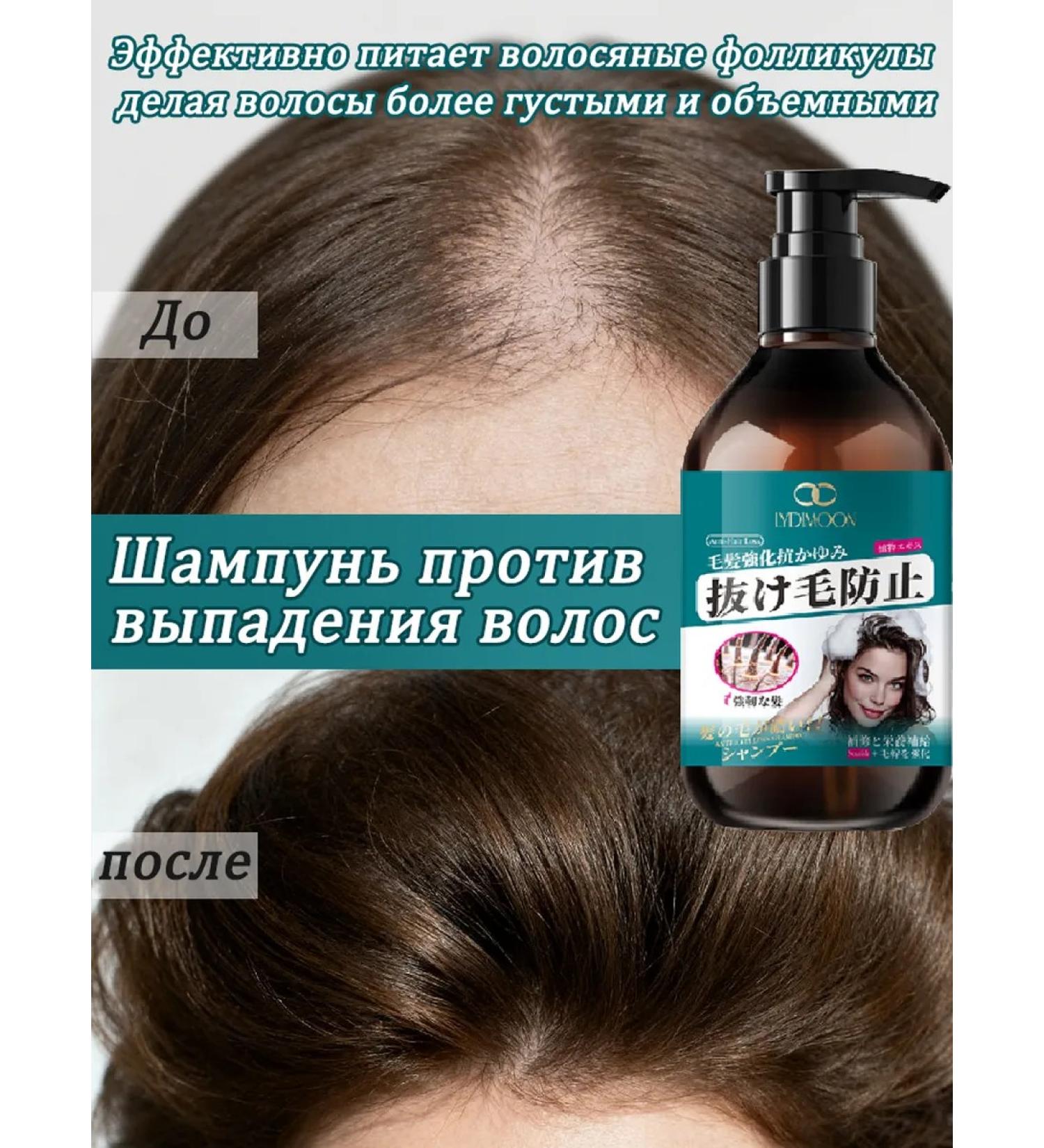 LYDIMOON Hair shampoo against hair loss 300 ml 5 bottles - Buy Online on GoSupps.com