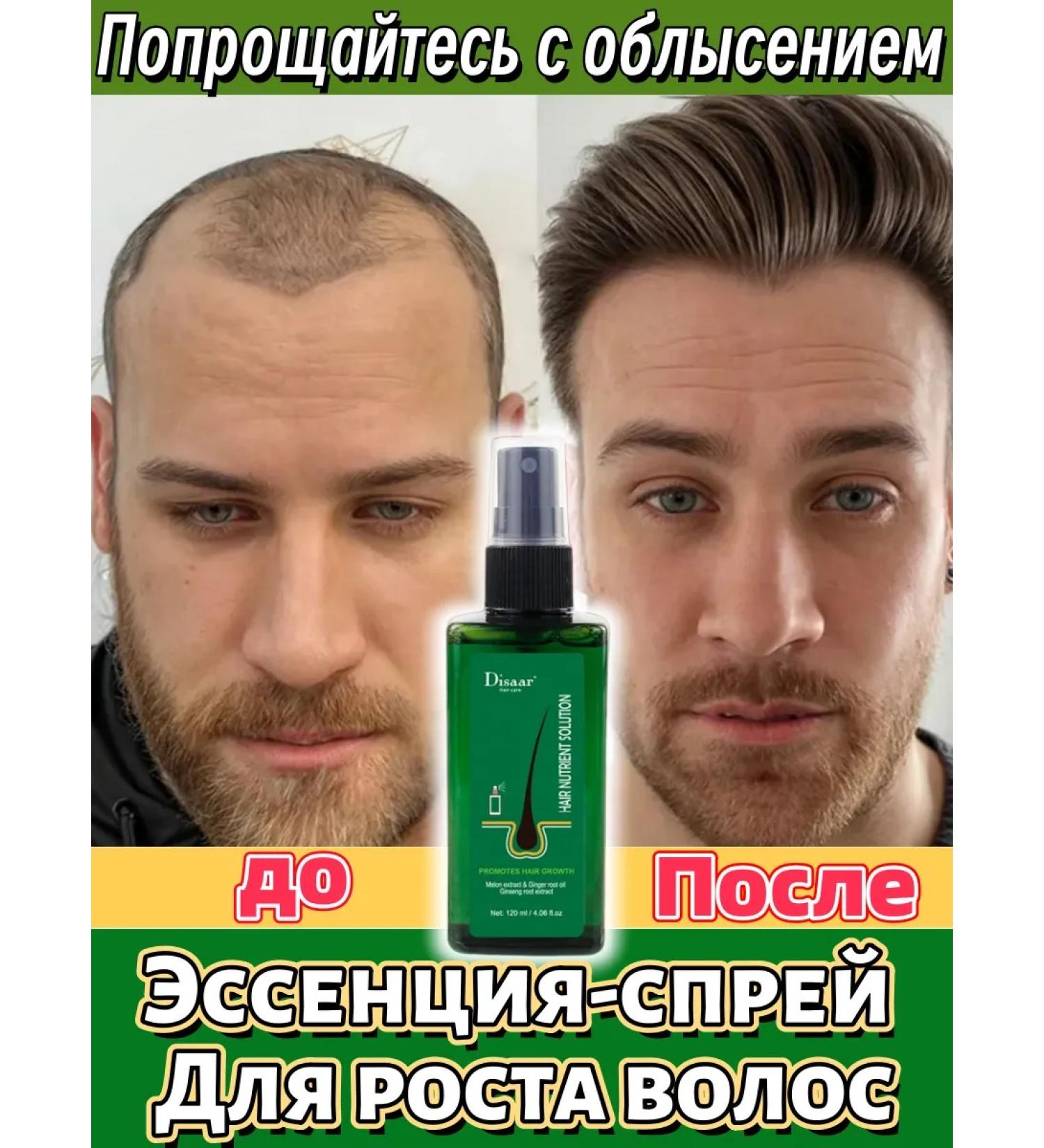 DRSKINVITA Hair growth nourishing and caring - Buy Online on GoSupps.com