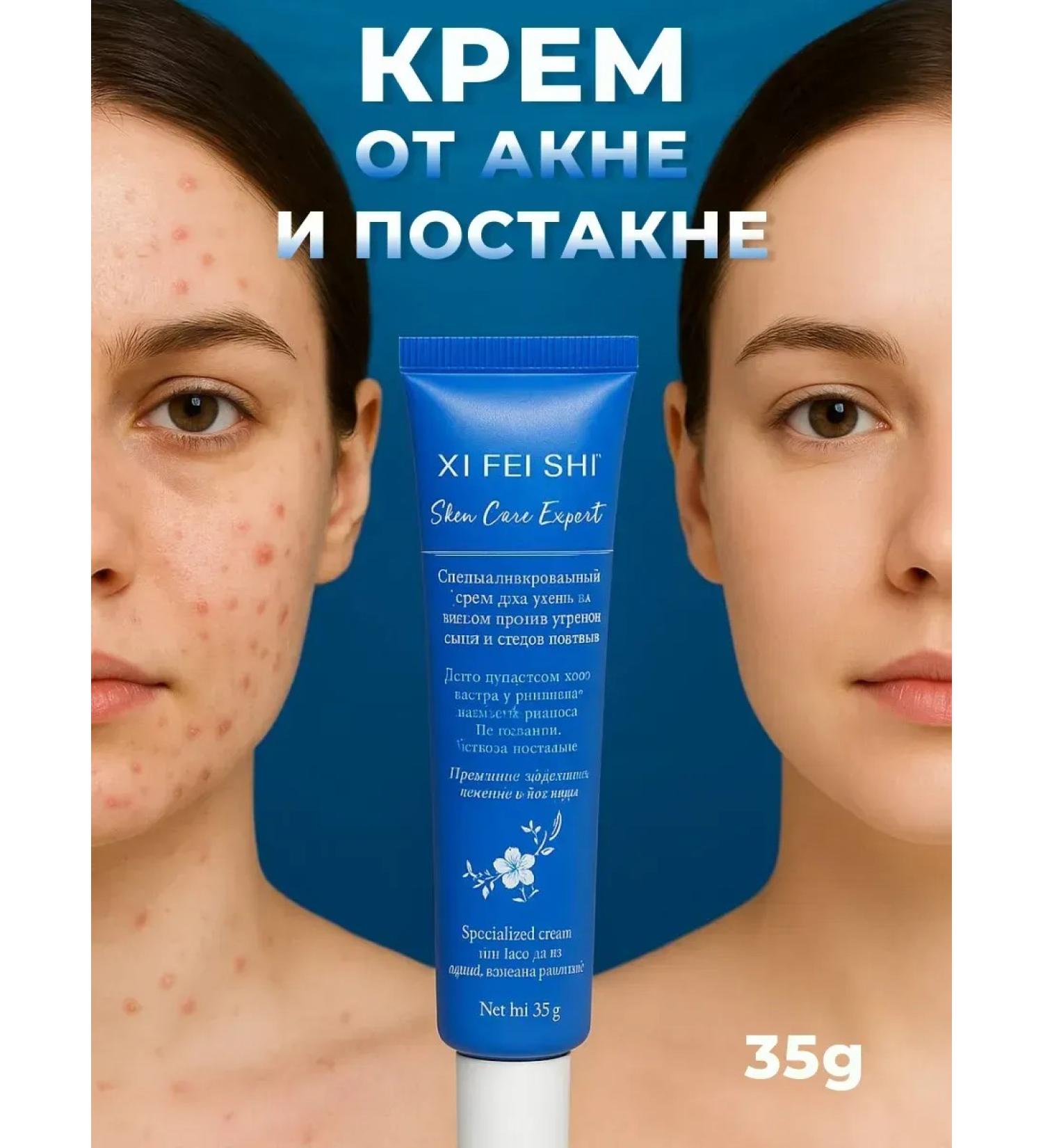 MOON2705 Cream from acne and post -acne from acne and acne rash - Buy Online on GoSupps.com