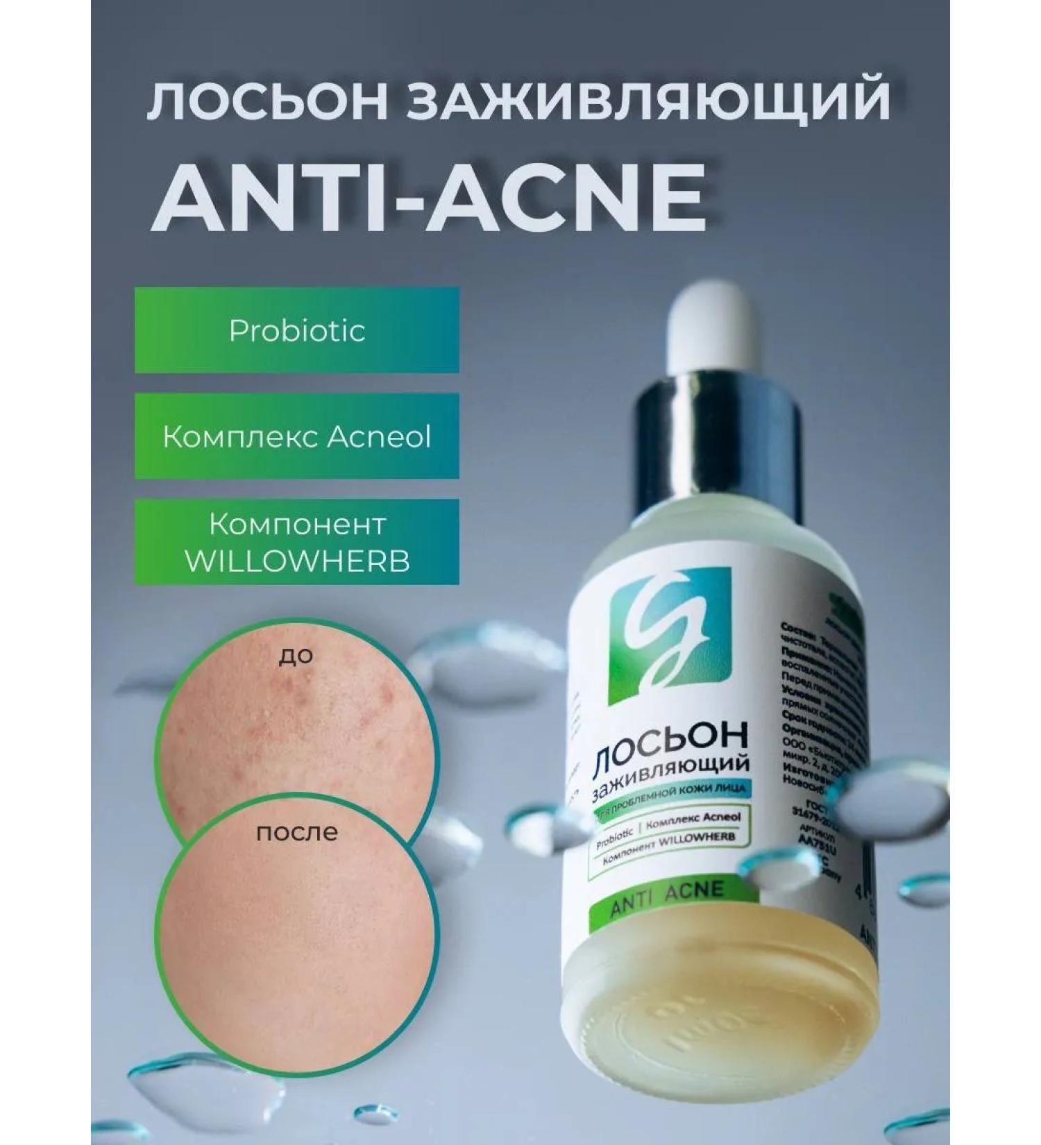 girlsss secret Facial lotion from acne - Buy Online on GoSupps.com