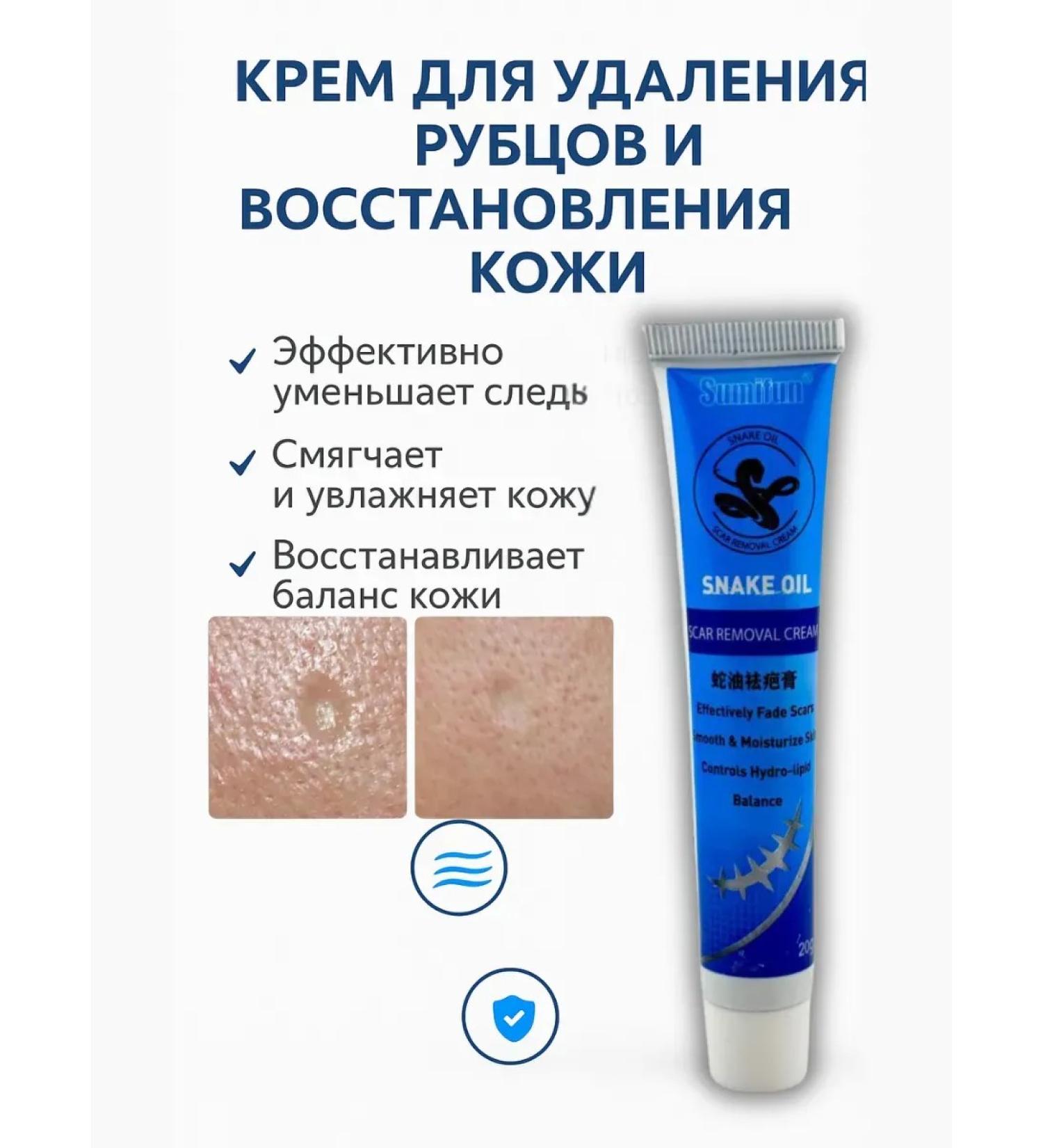 house 78 Cream for removing scars and skin restoration - Buy Online on GoSupps.com