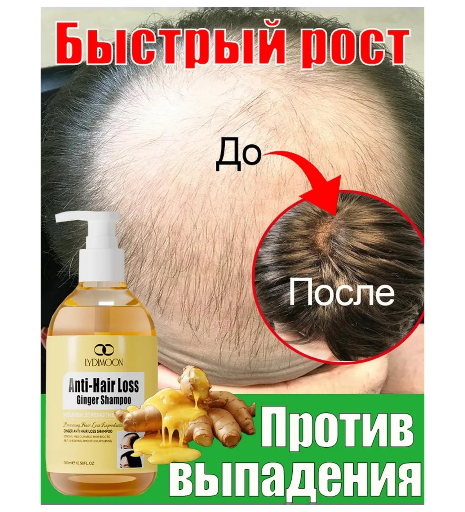 LYDIMOON Shampoo with ginger for hair from falling out professional - Buy Online on GoSupps.com