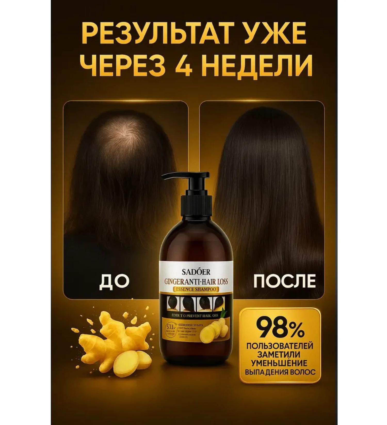 AEA94 Ginger shampoo with baldness-500ml - Buy Online on GoSupps.com