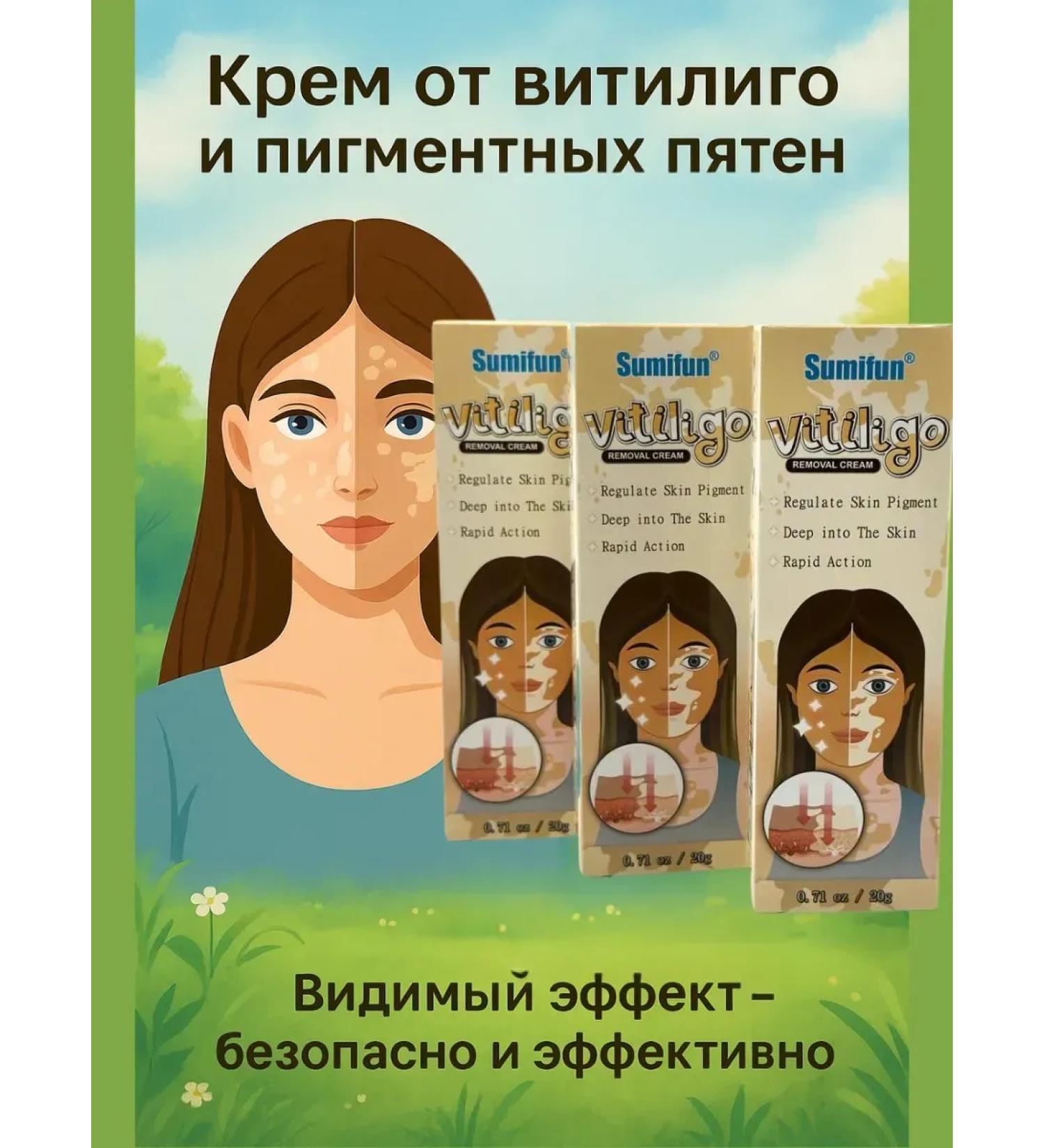 Dubai luxury Vitiligo cream - to restore skin pigmentation 3 pcs - Buy Online on GoSupps.com