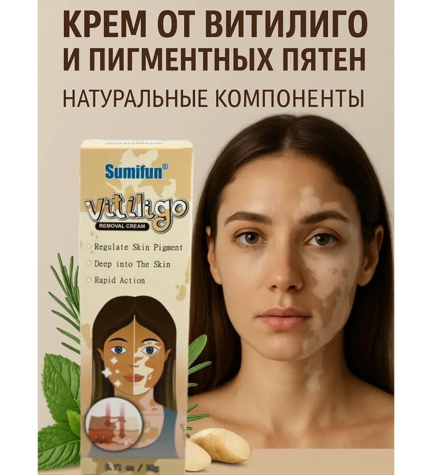 ANEL 1 Vitiligo cream and age spots - 3pcs - Buy Online on GoSupps.com