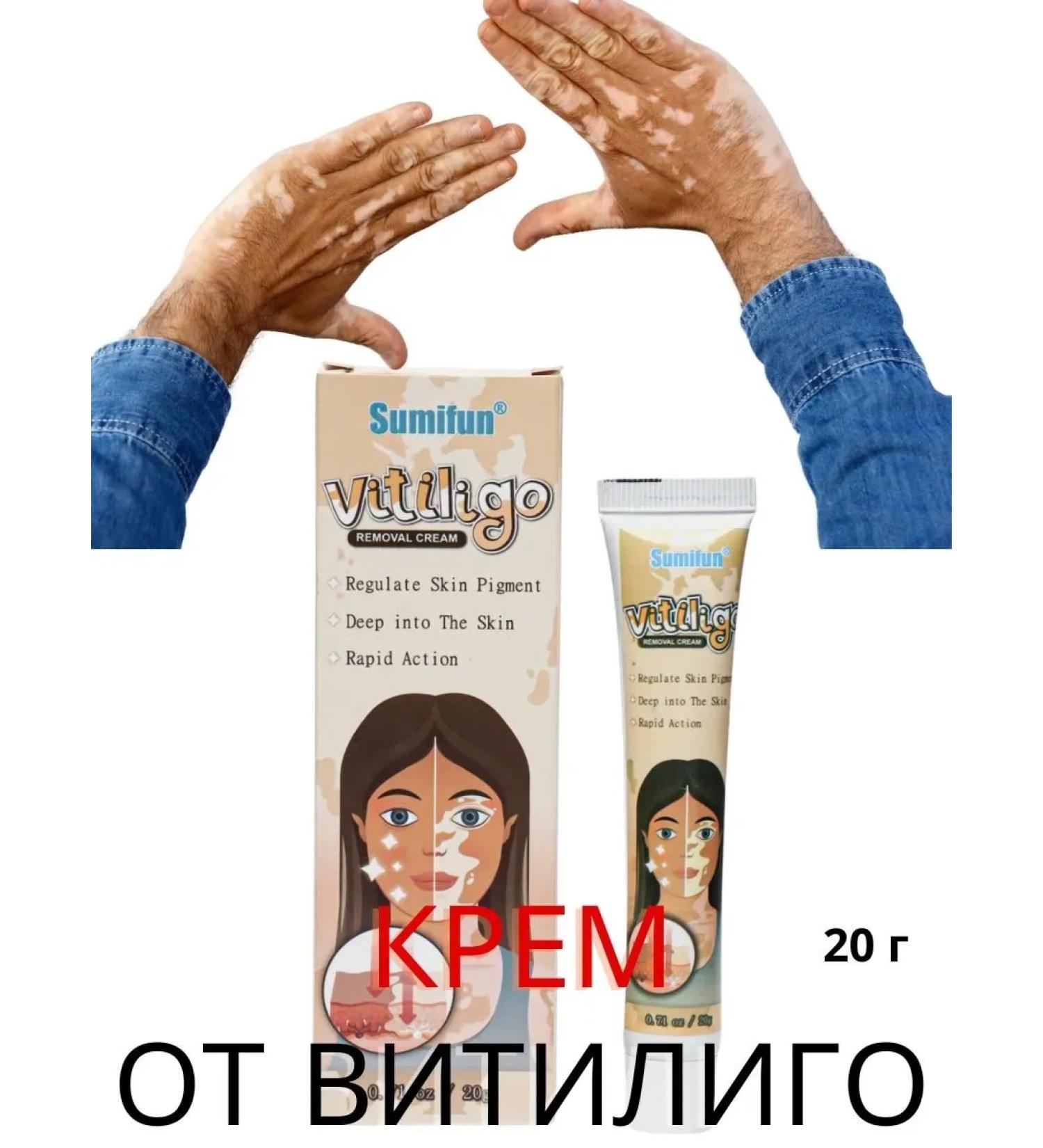 Nail25 beauty and health Cream from pigmentation of vitiligo stains - Buy Online on GoSupps.com