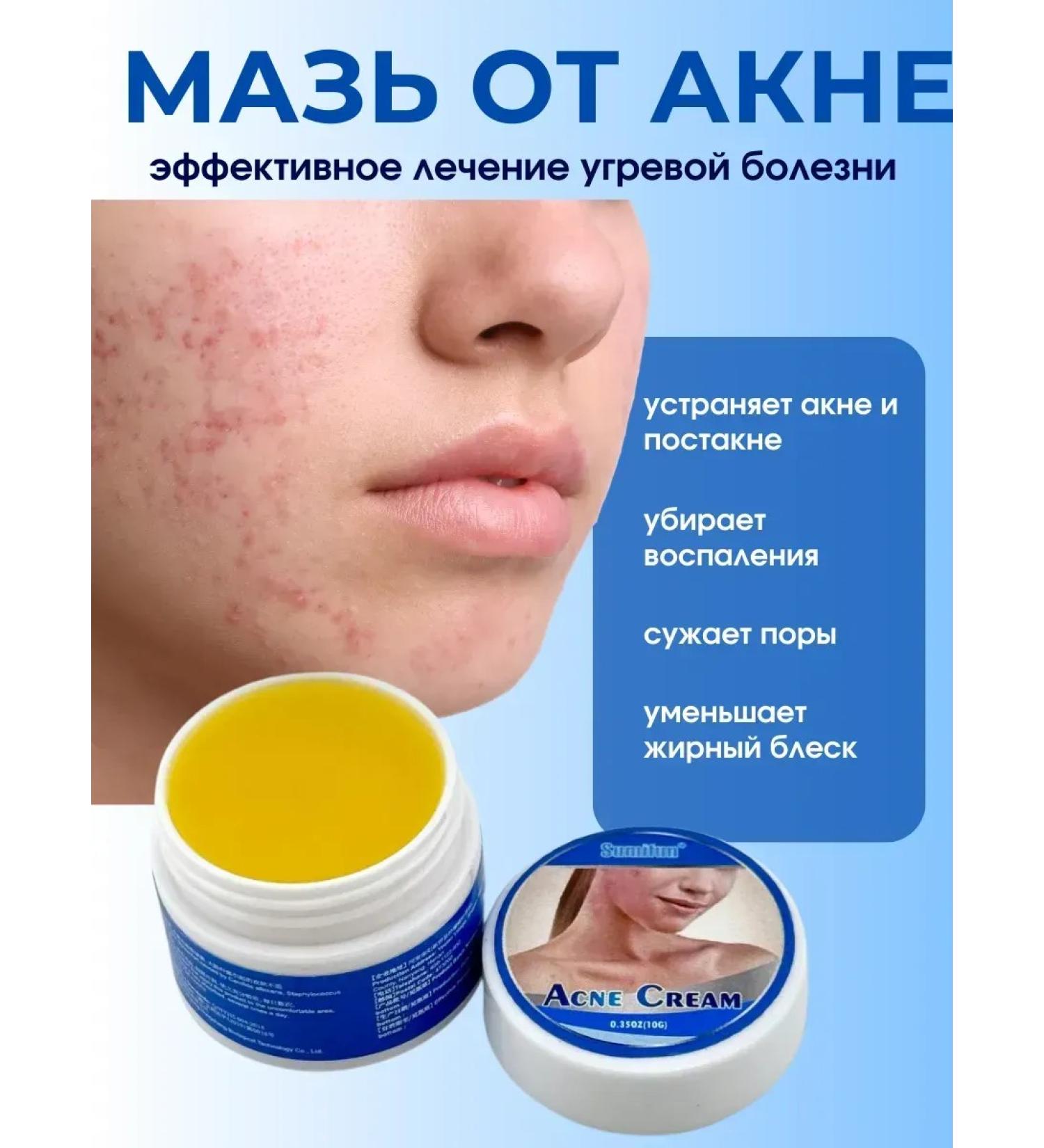 NazzHome Acne with acne on the face for teenagers and adults - Buy Online on GoSupps.com