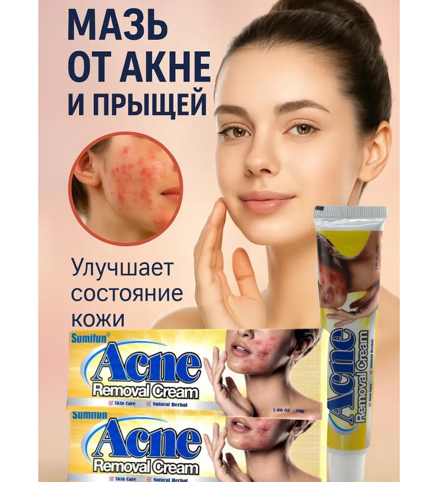 ANEL 1 Acne ointment and acne set 3 pcs - Buy Online on GoSupps.com